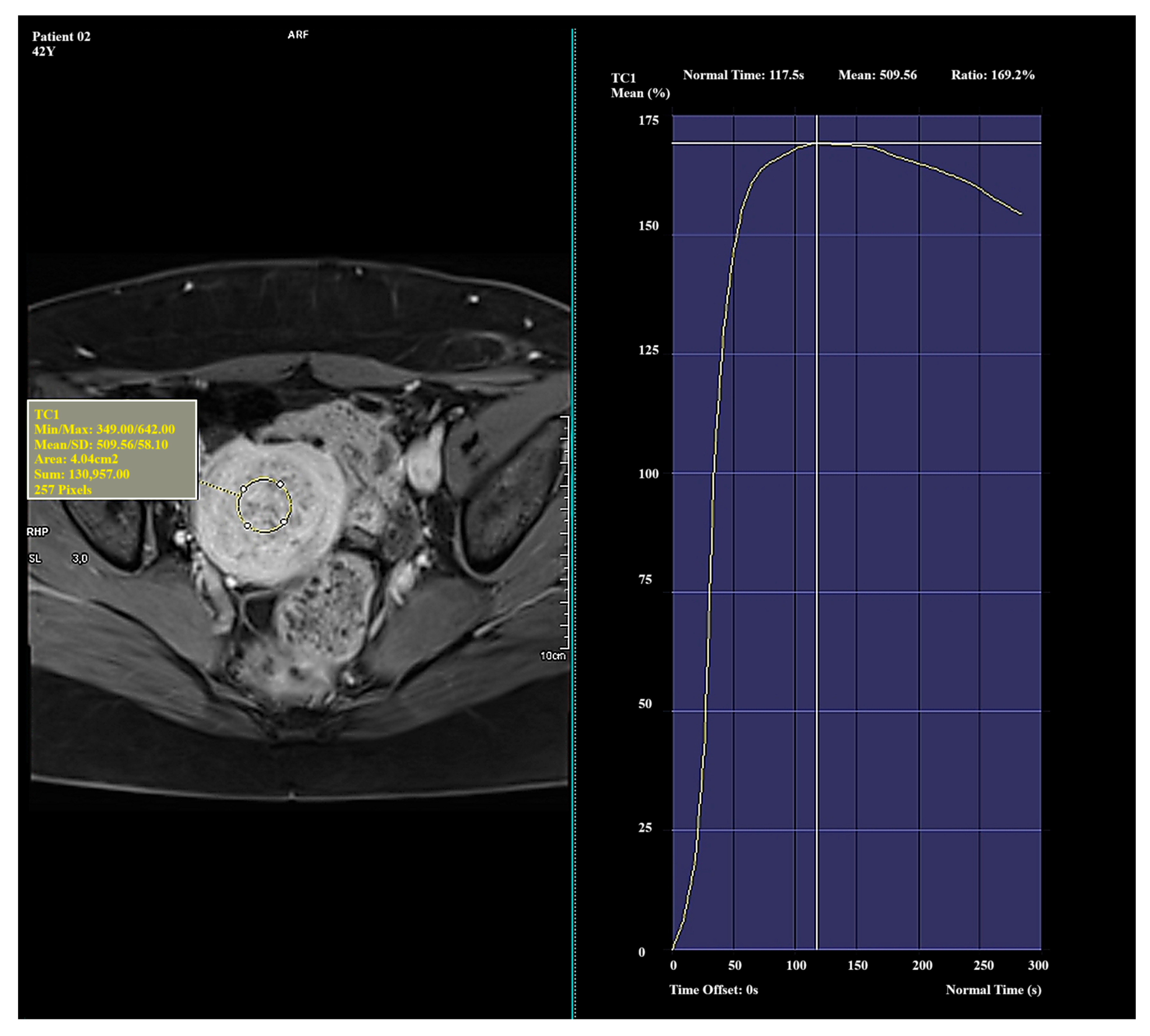Diagnostics 15 01464 g001