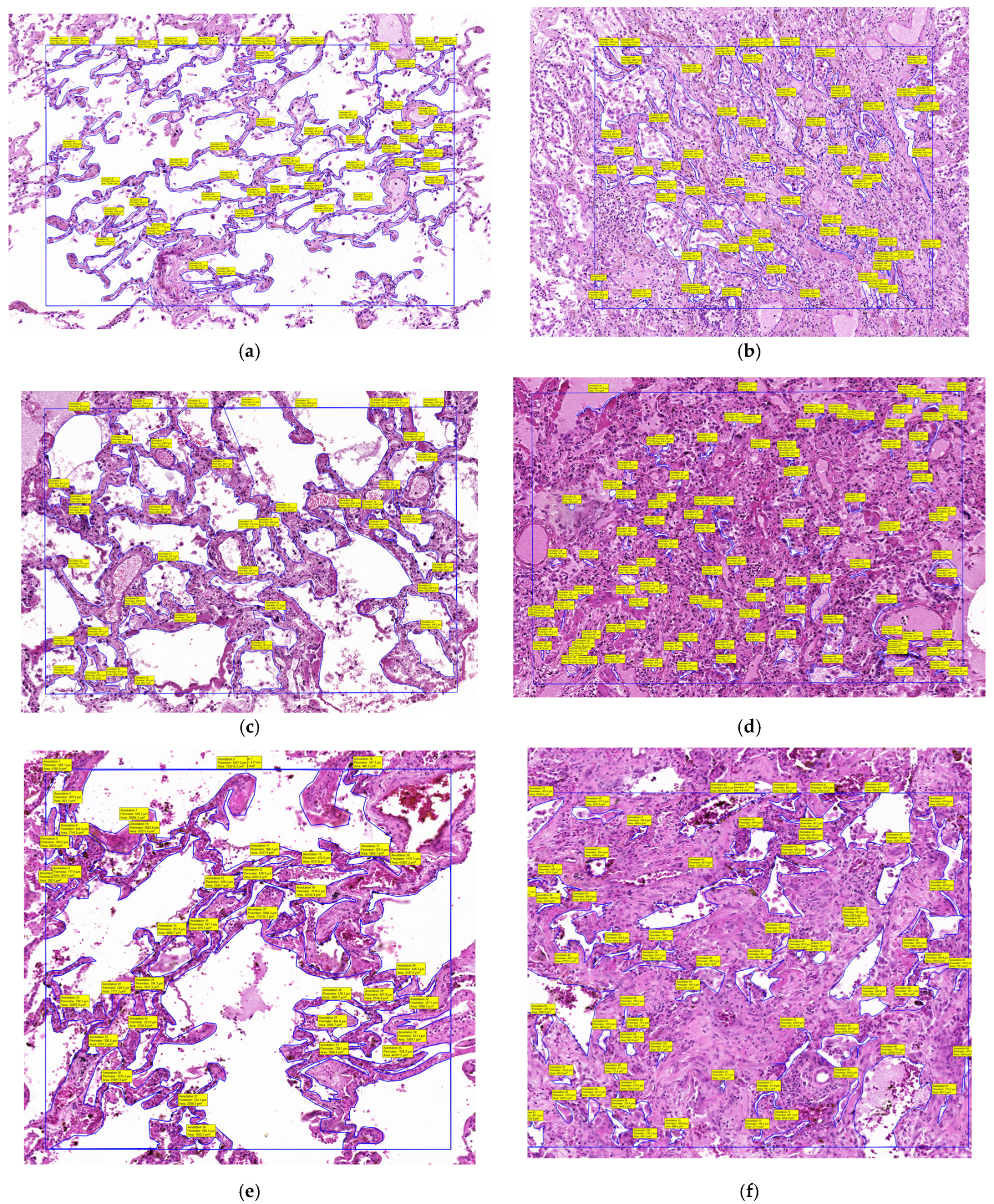 Diagnostics 15 01465 g002