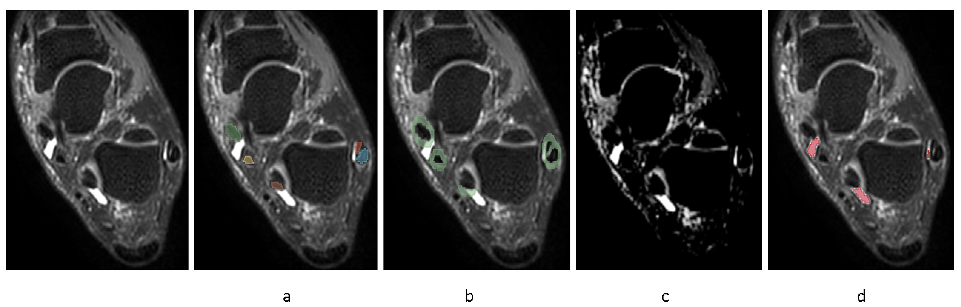 Diagnostics 15 01469 g002
