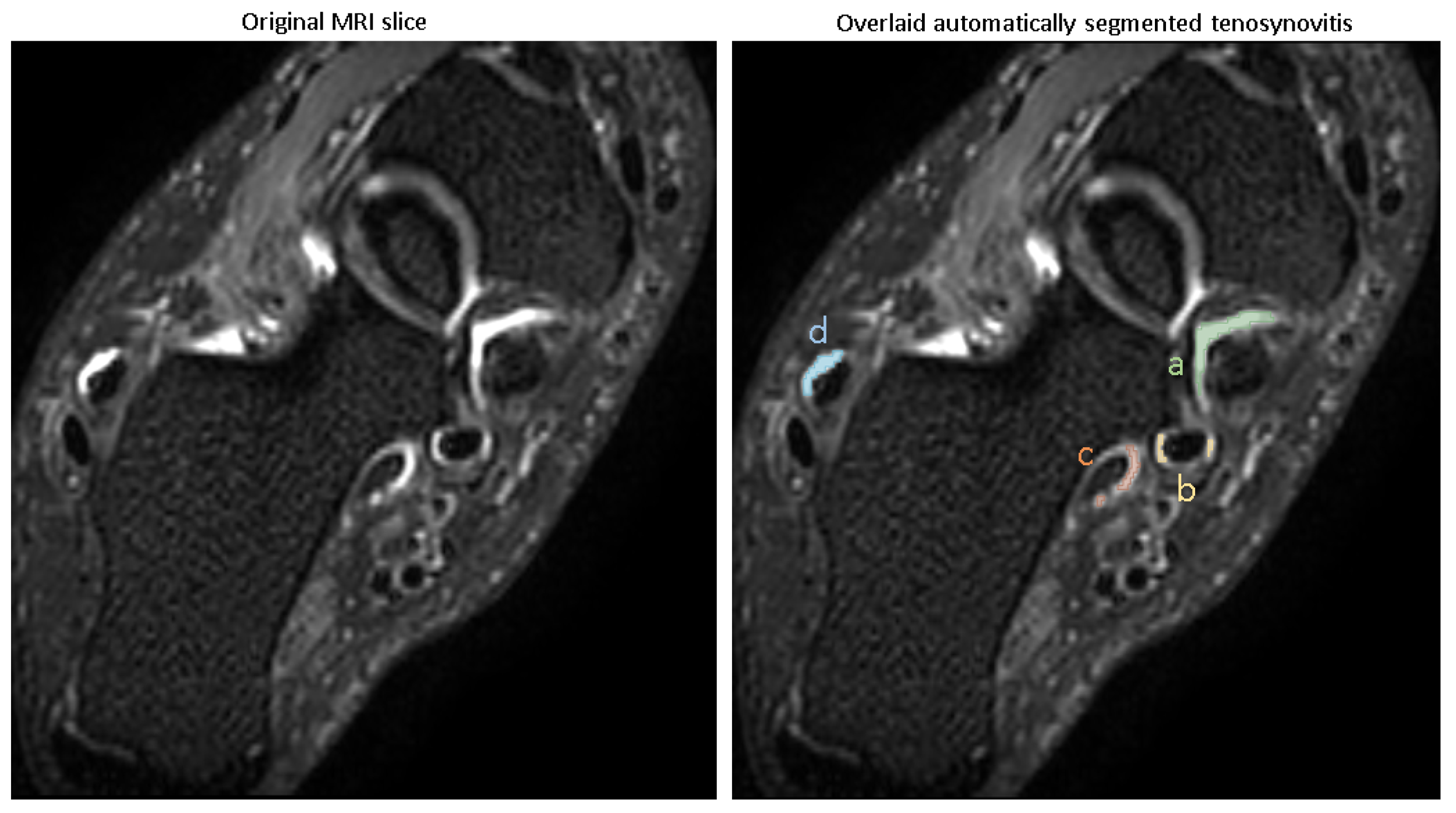 Diagnostics 15 01469 g004