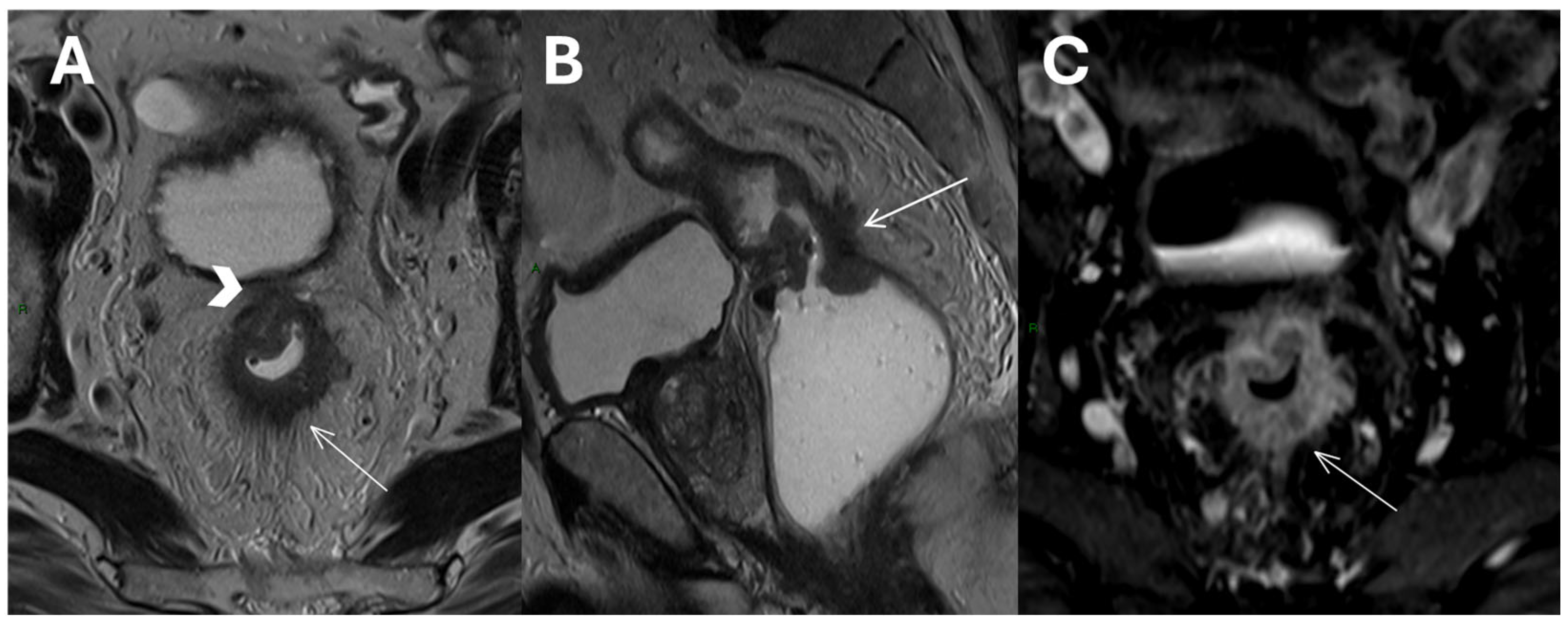 Diagnostics 15 01472 g002 Diagnostics 15 01472 g002