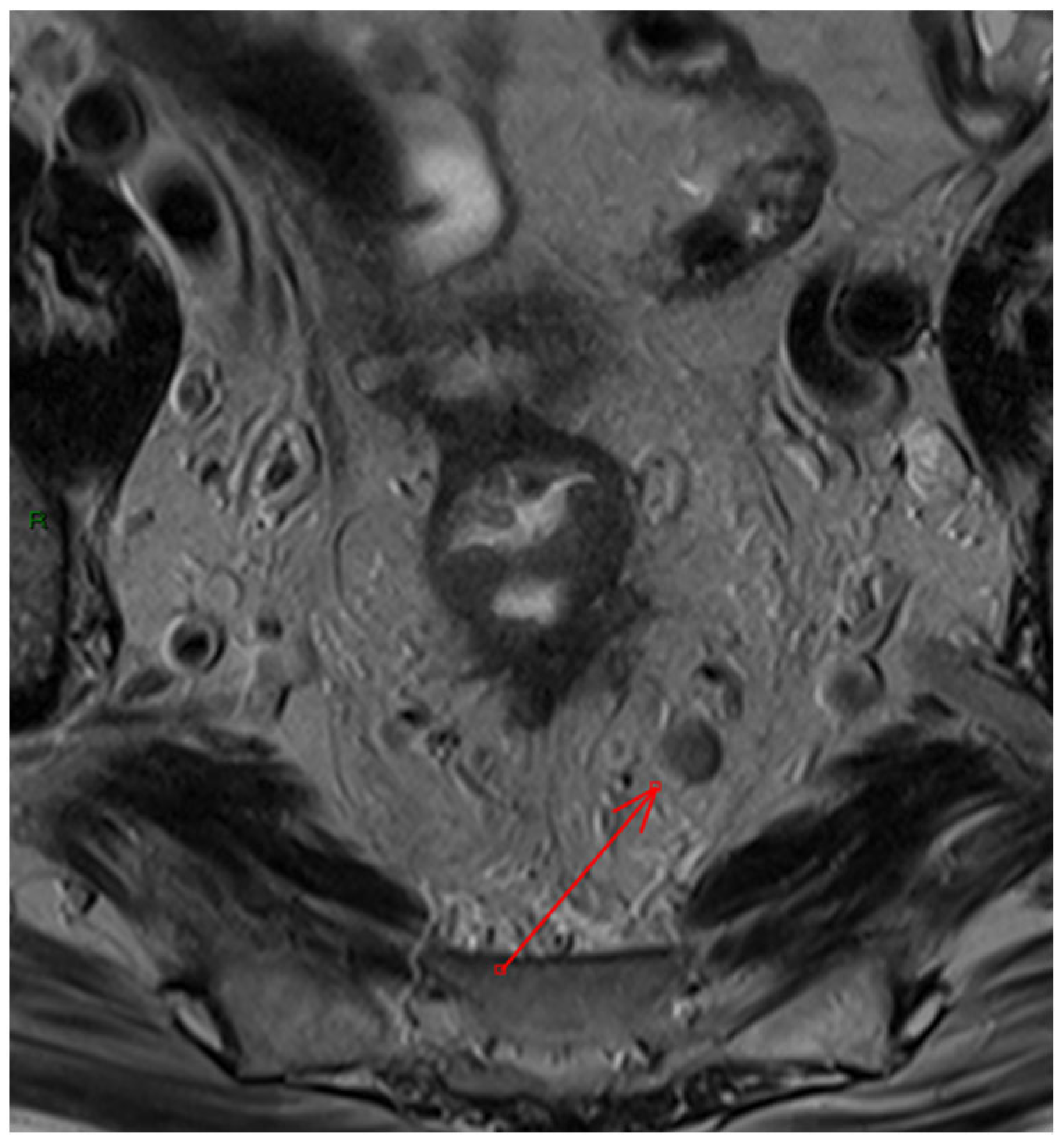 Diagnostics 15 01472 g003 Diagnostics 15 01472 g003