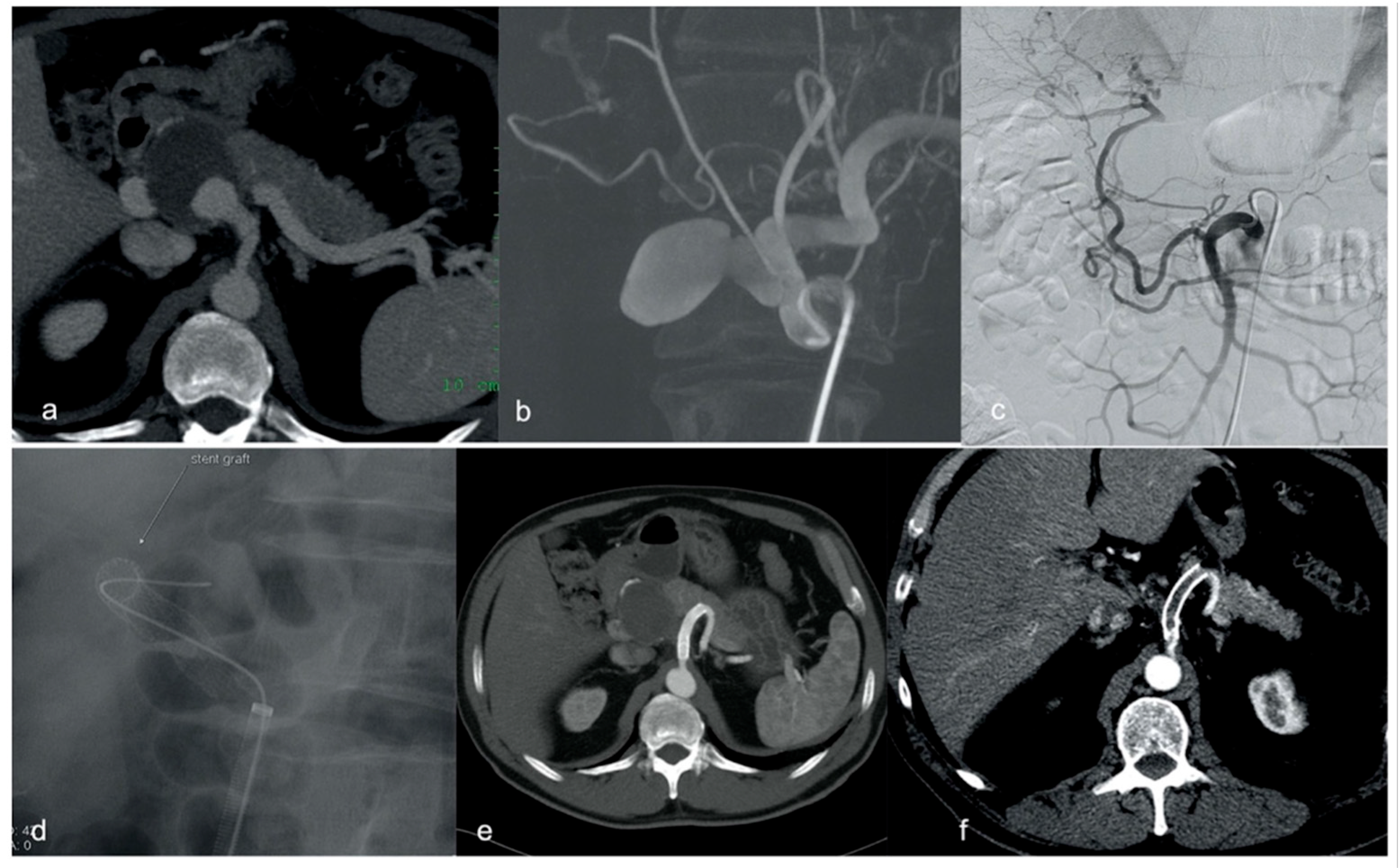 Diagnostics 15 01481 g002