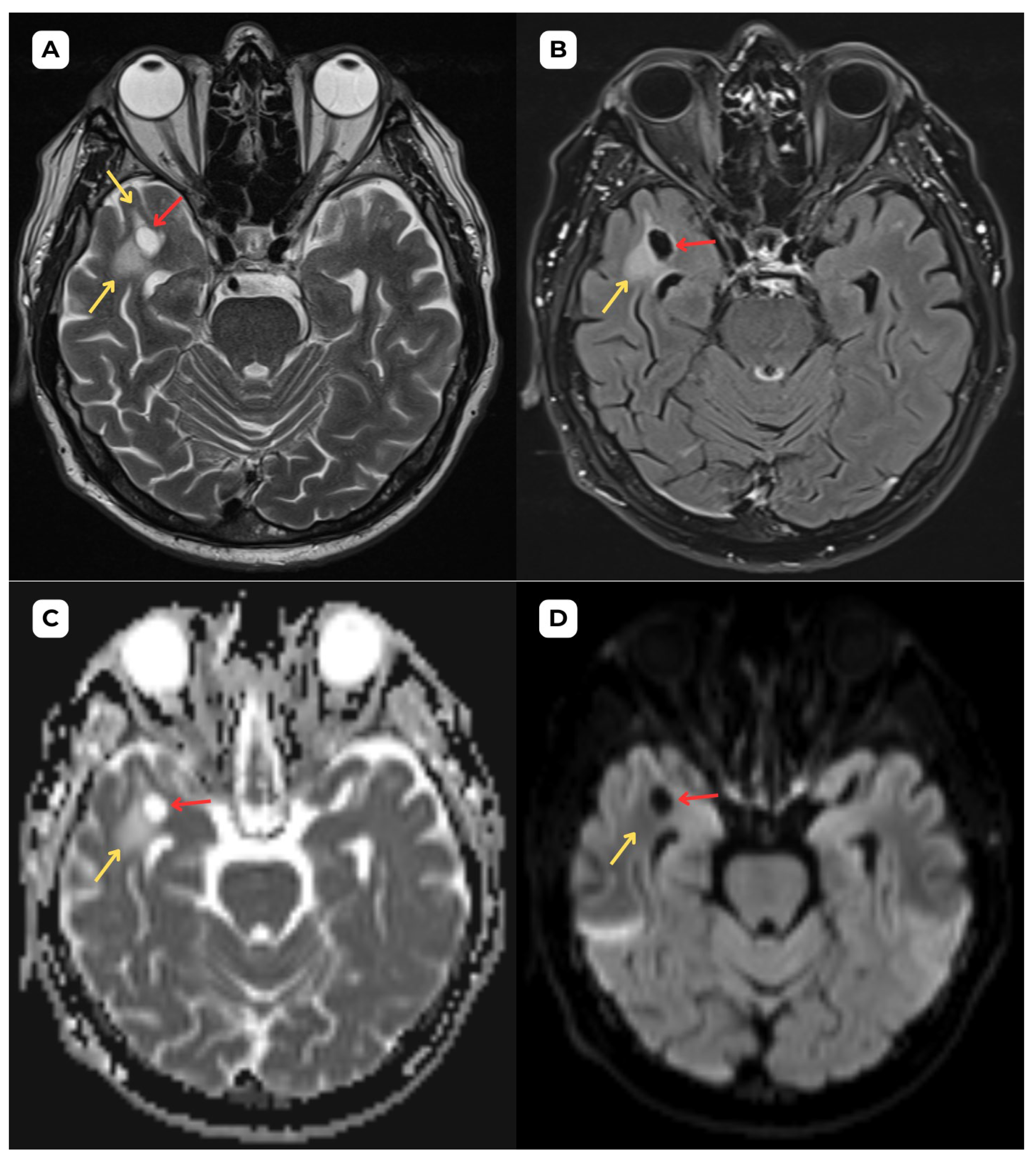 Diagnostics 15 01486 g001