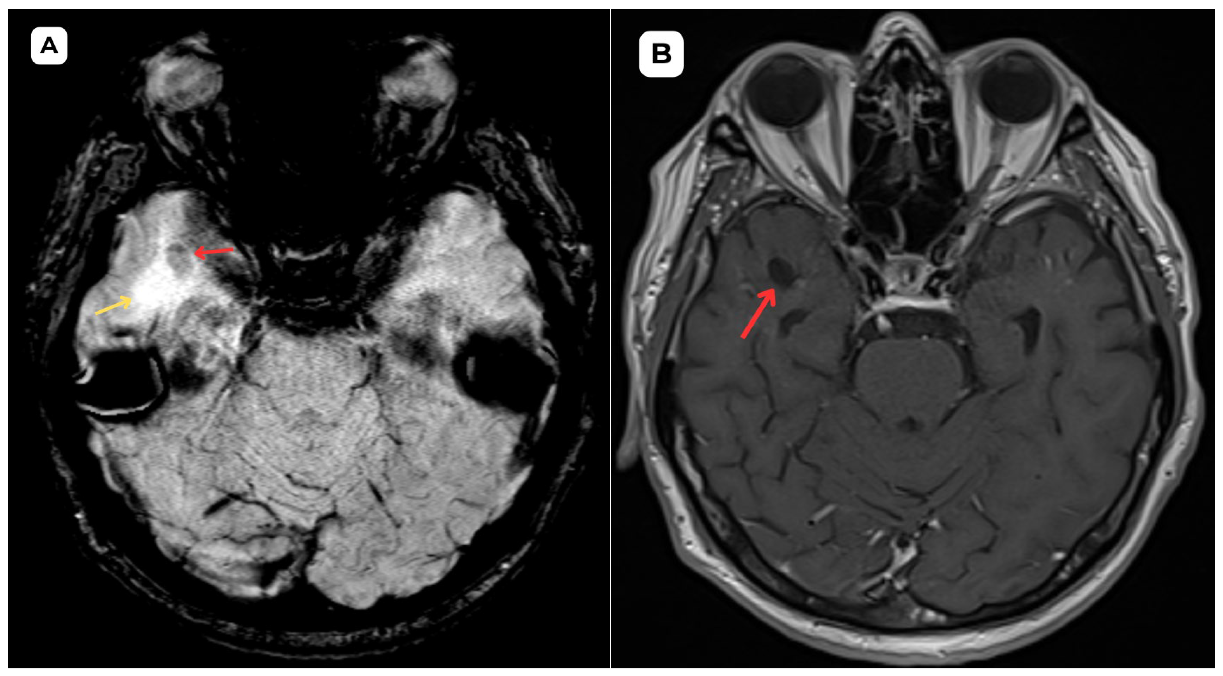 Diagnostics 15 01486 g002