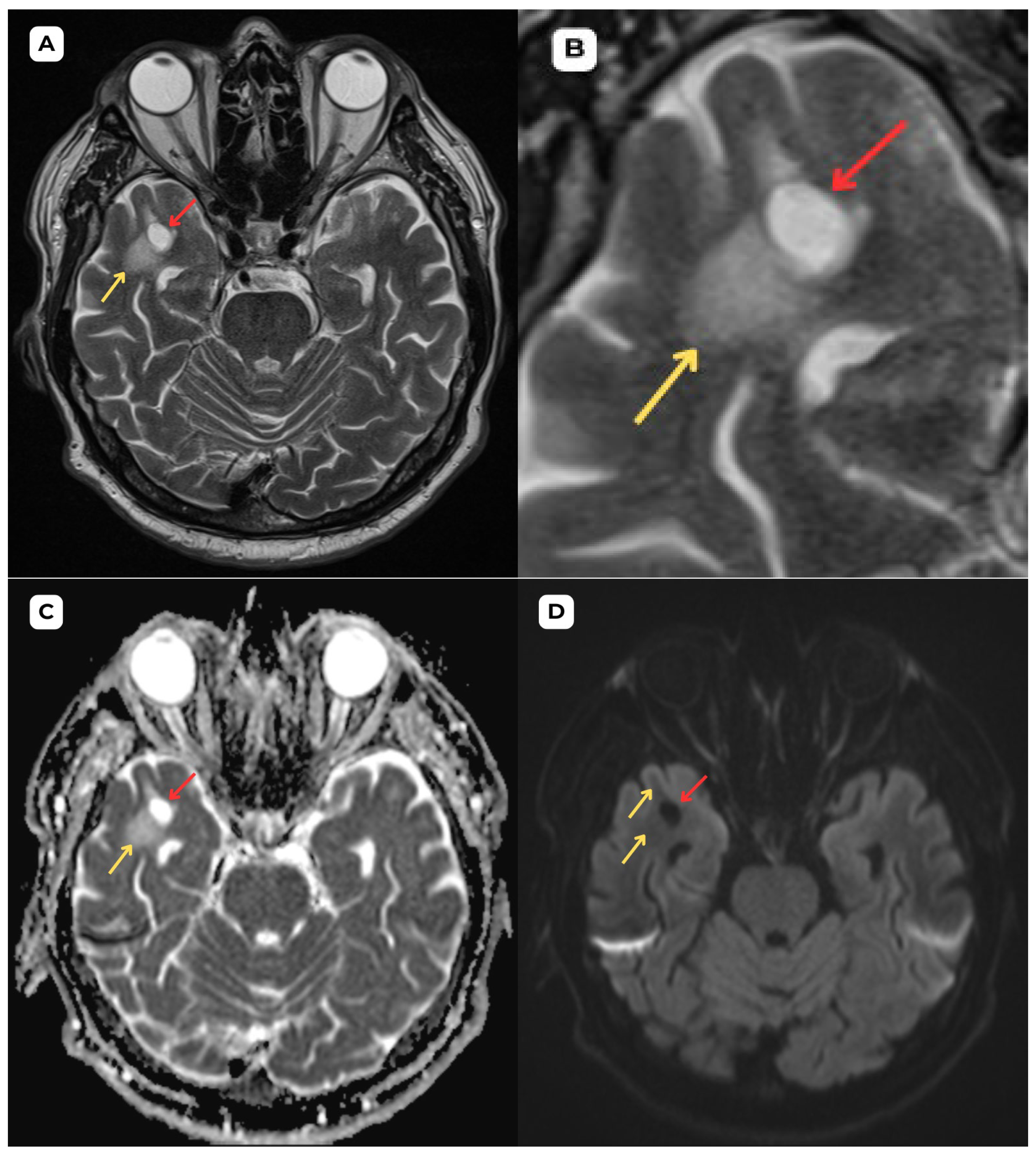 Diagnostics 15 01486 g003