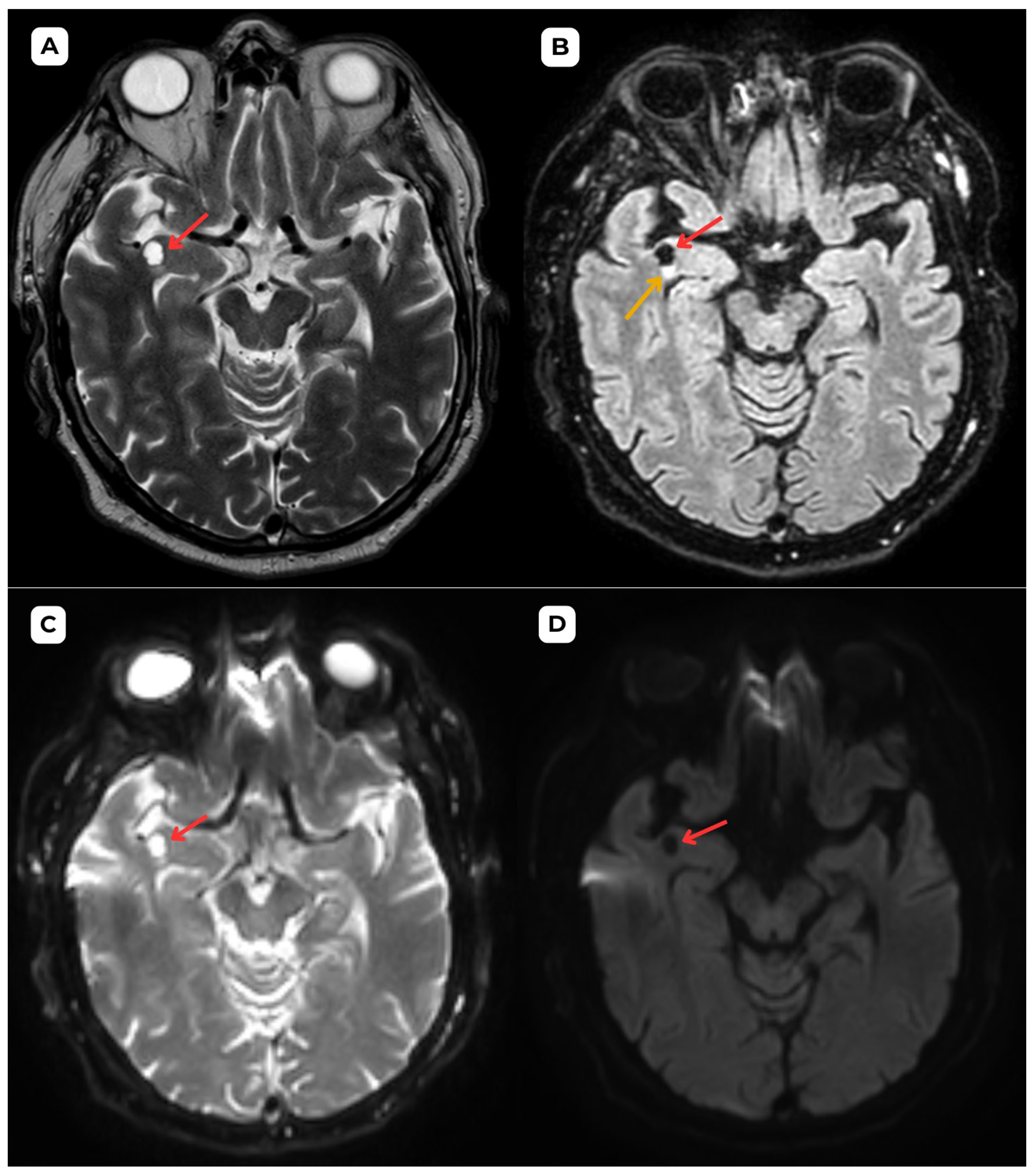 Diagnostics 15 01486 g004