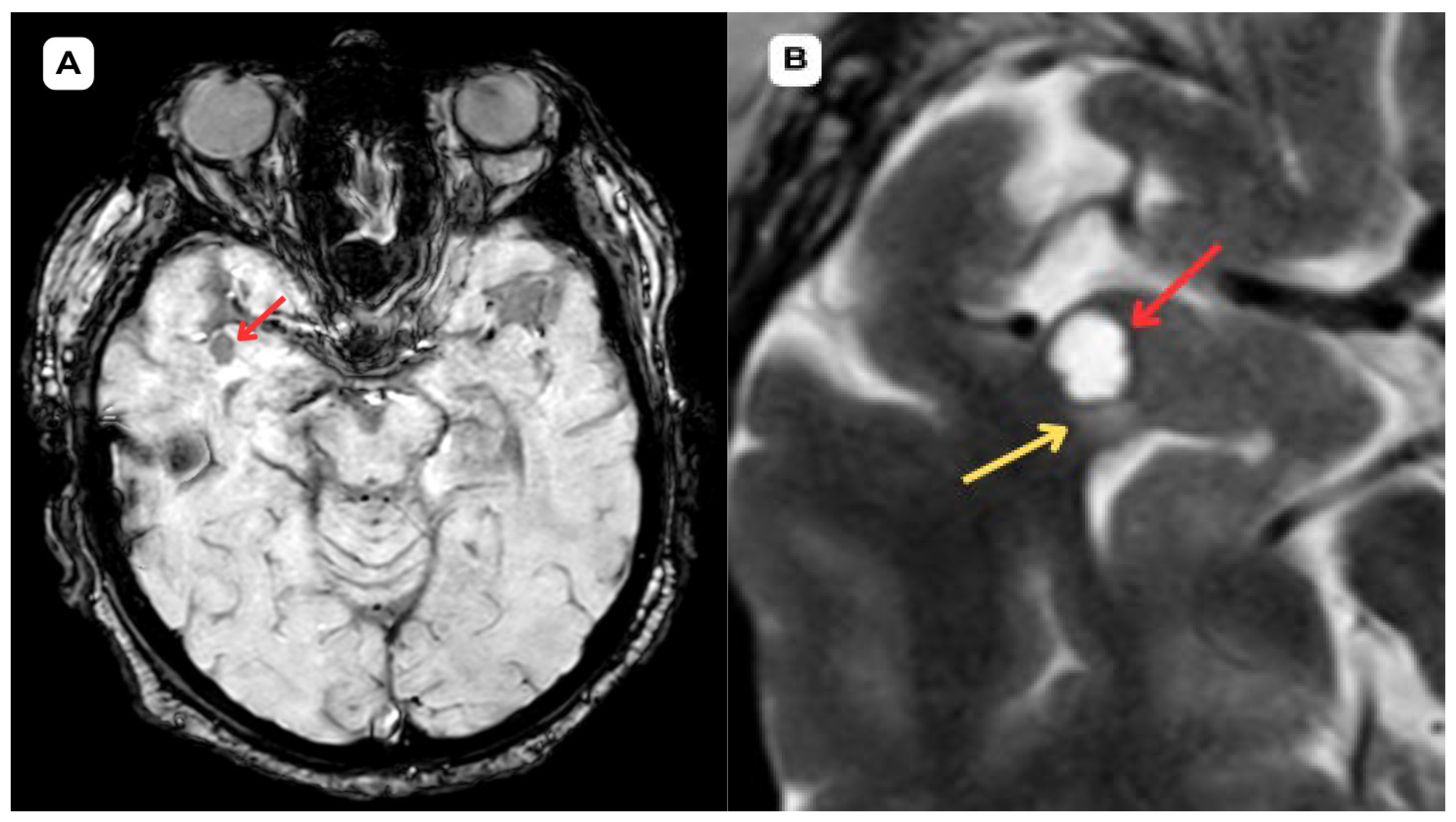 Diagnostics 15 01486 g005