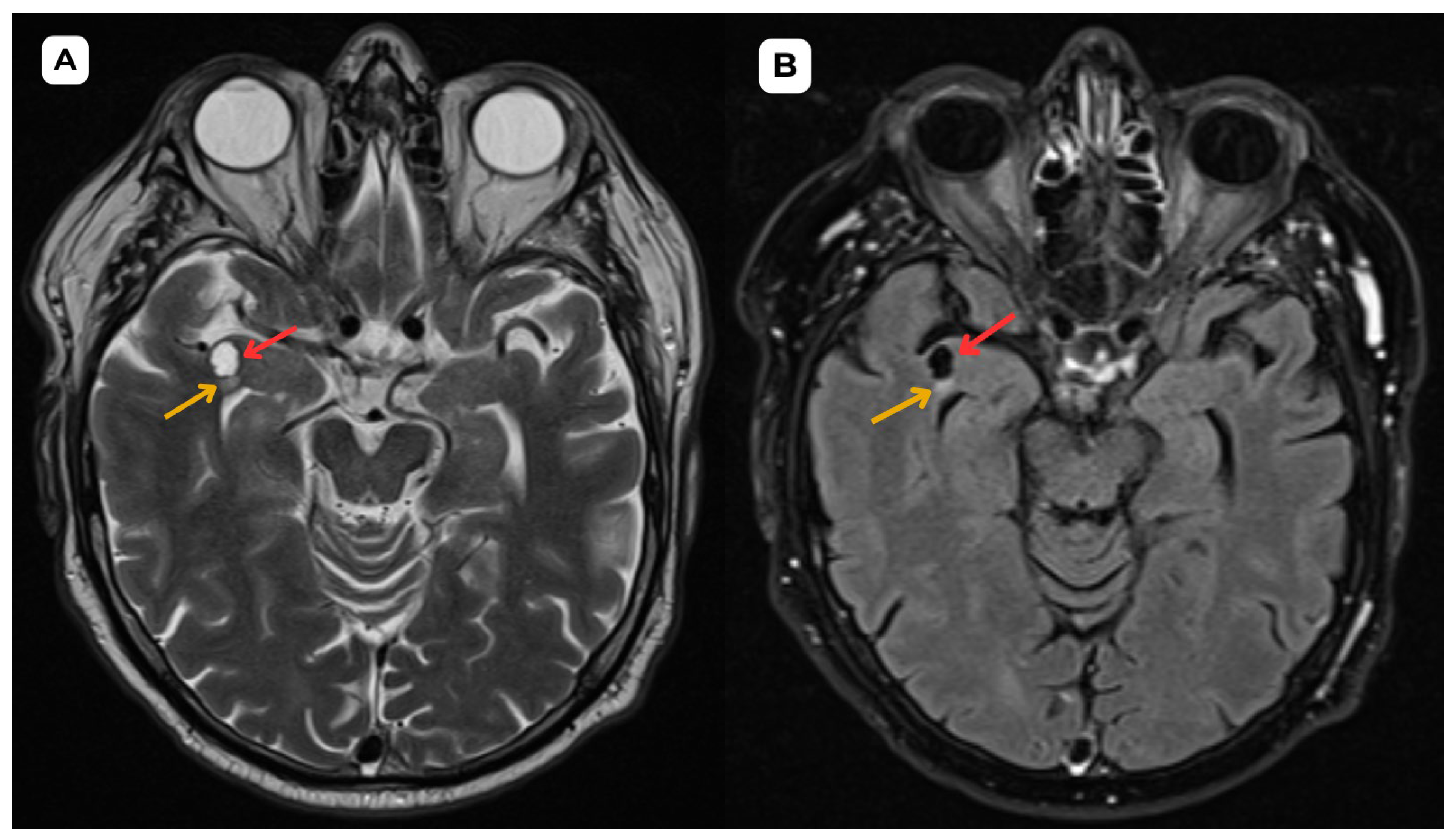 Diagnostics 15 01486 g006