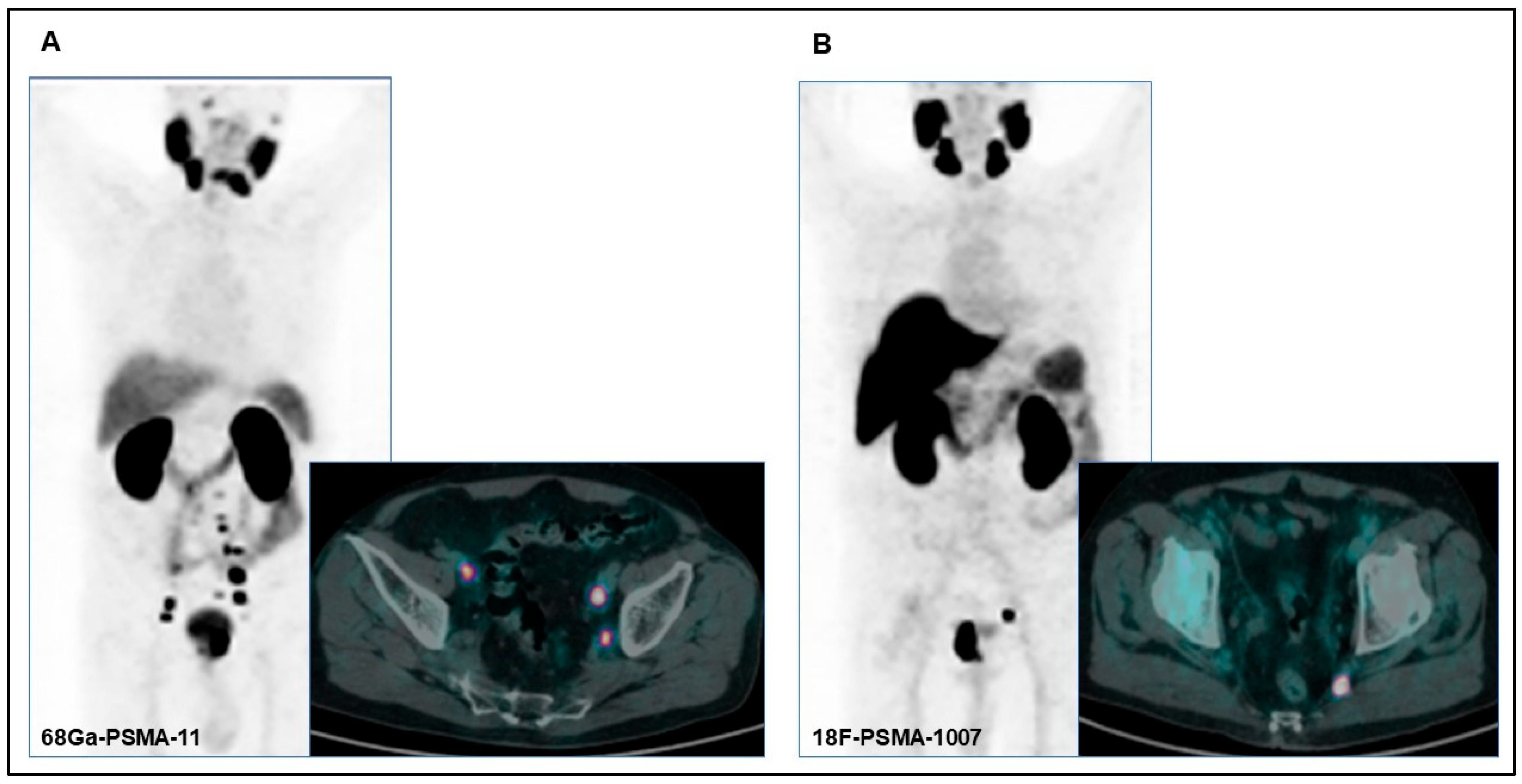 Diagnostics 15 01492 g001