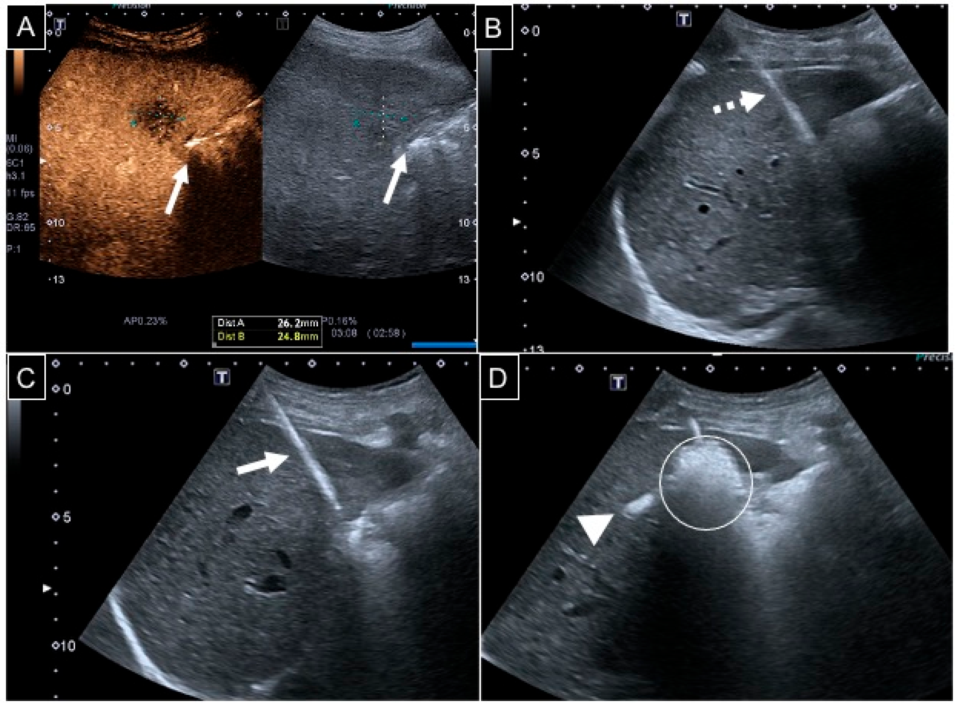 Diagnostics 15 01495 g001