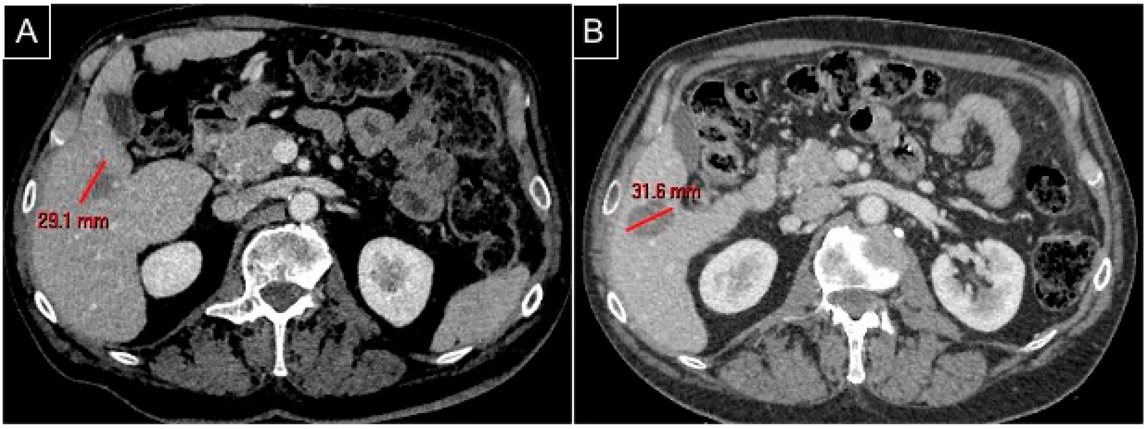 Diagnostics 15 01495 g002