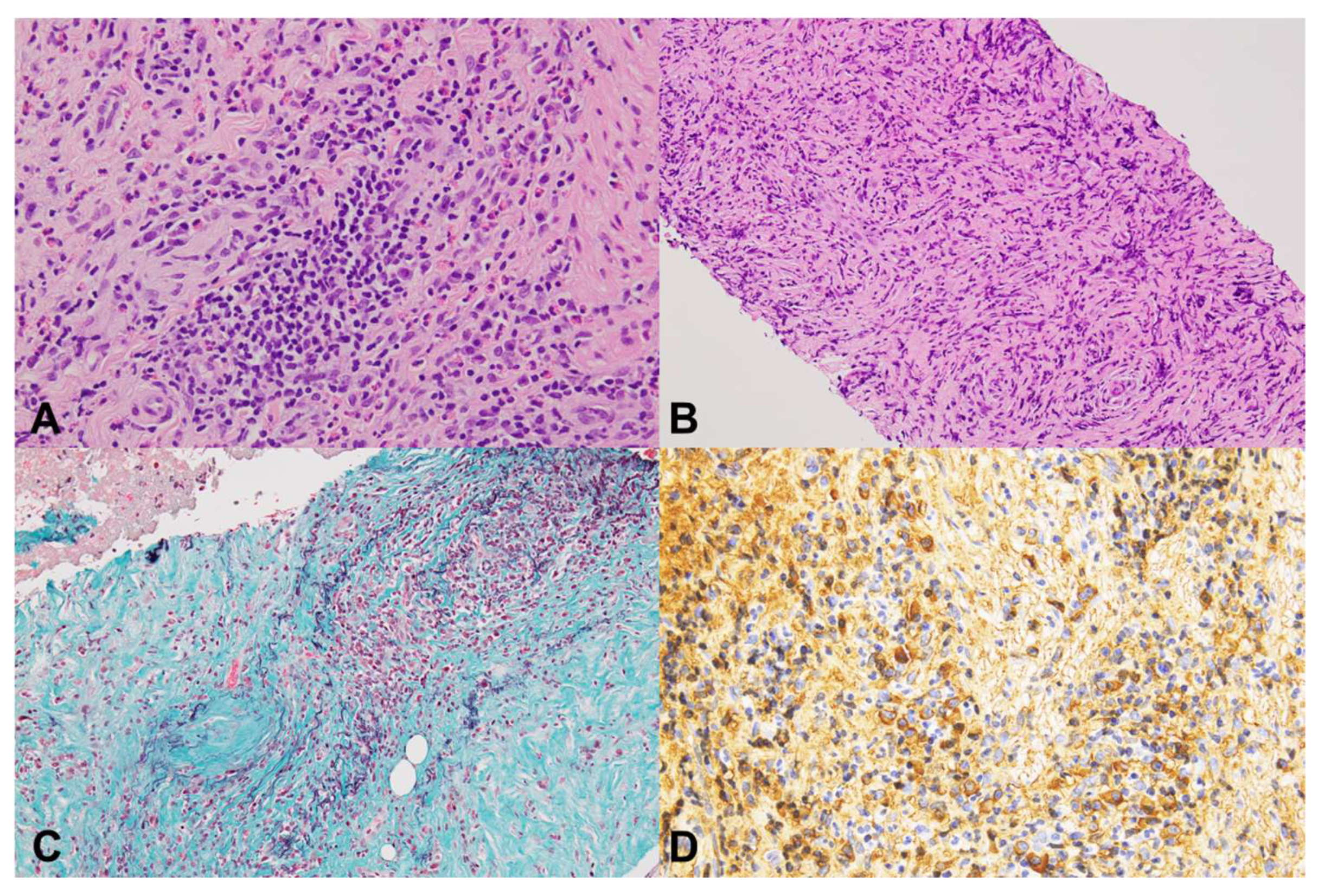 Diagnostics 15 01496 g001
