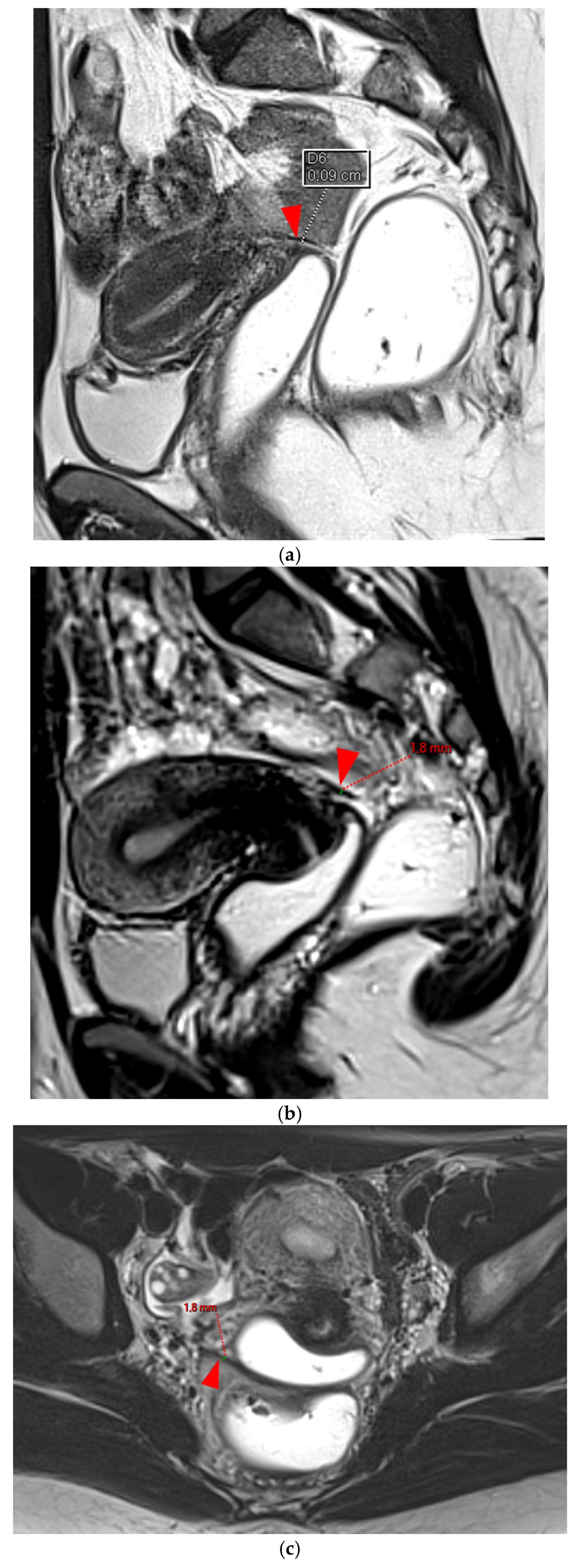 Diagnostics 15 01508 g002a