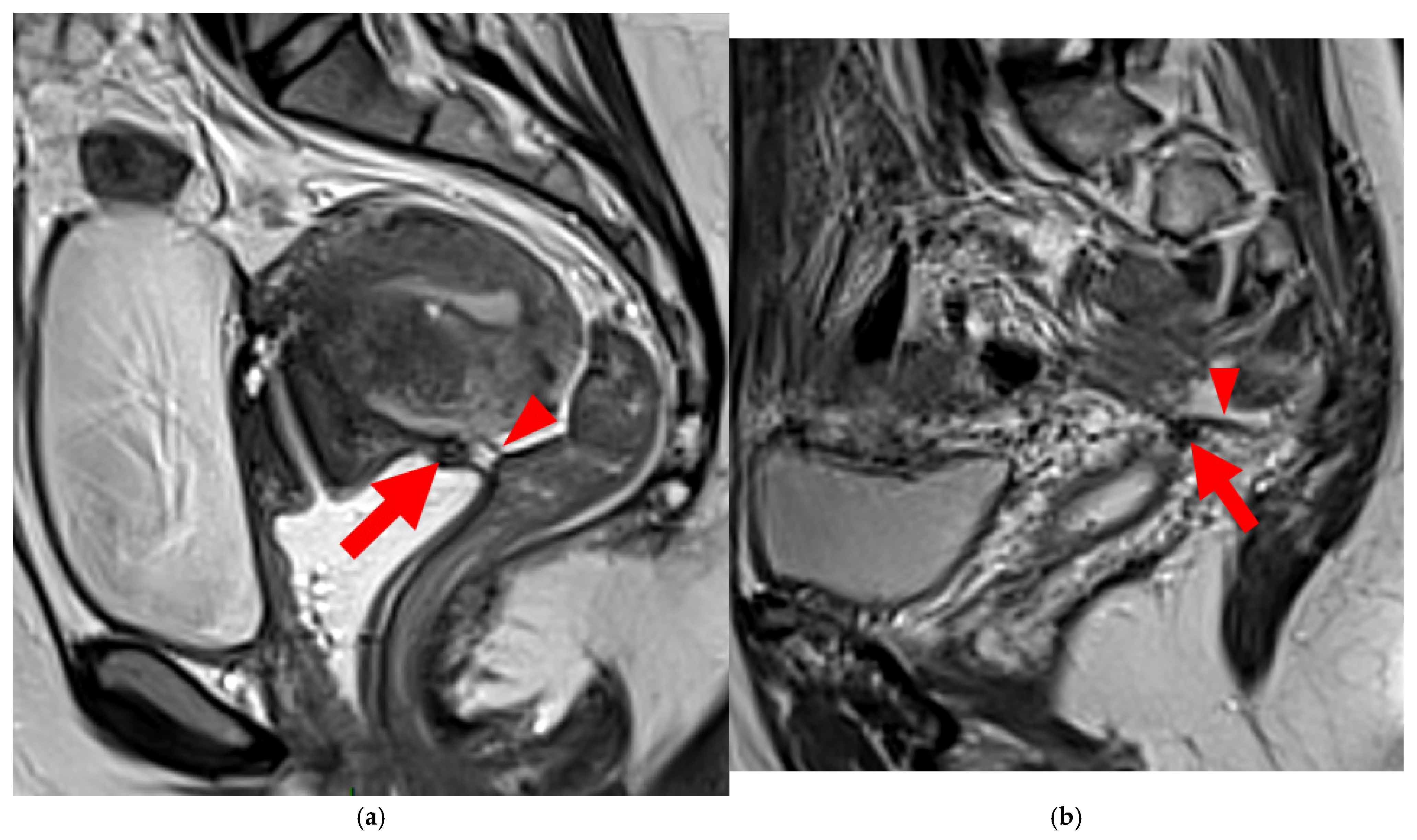Diagnostics 15 01508 g006