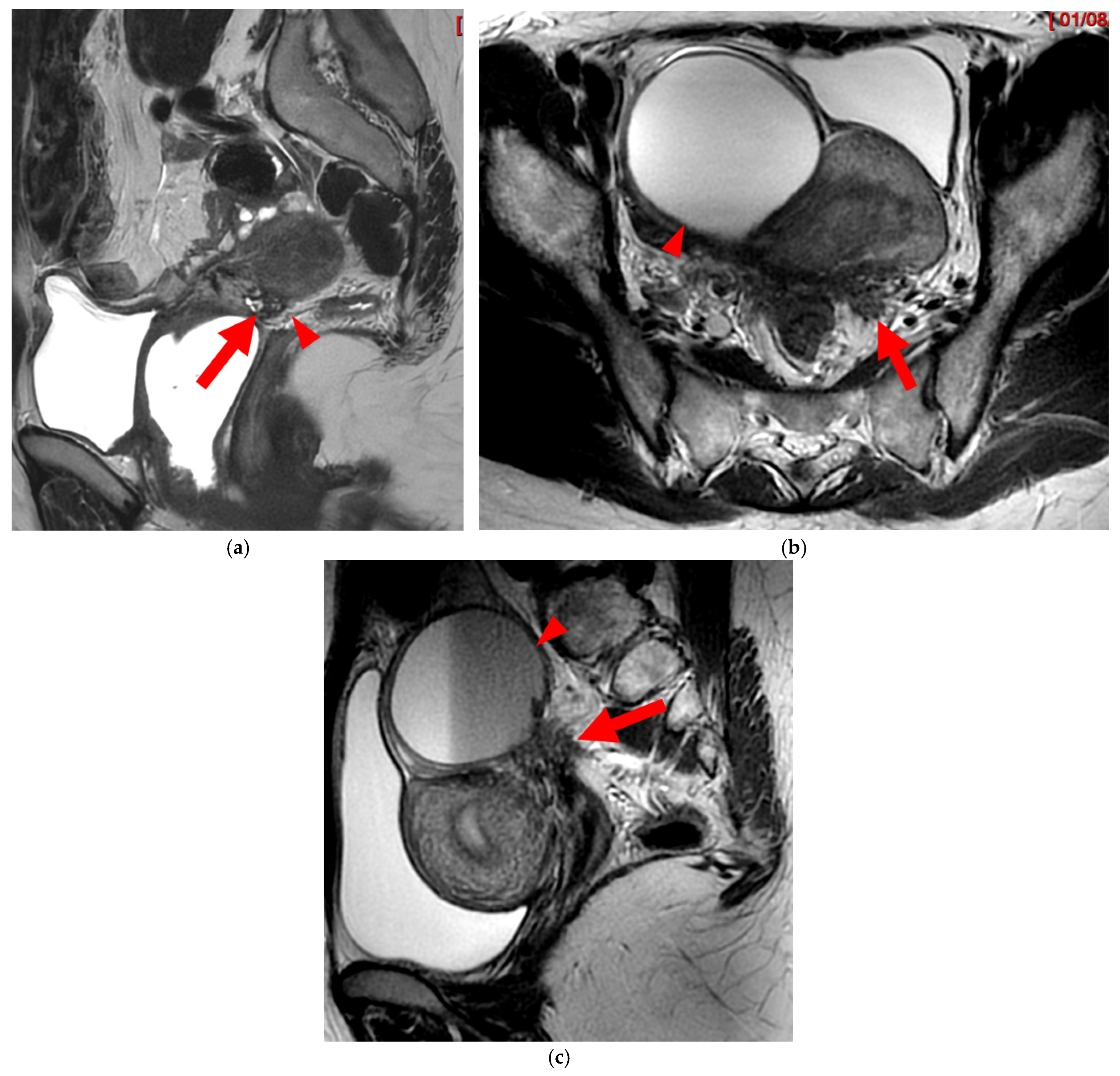 Diagnostics 15 01508 g007