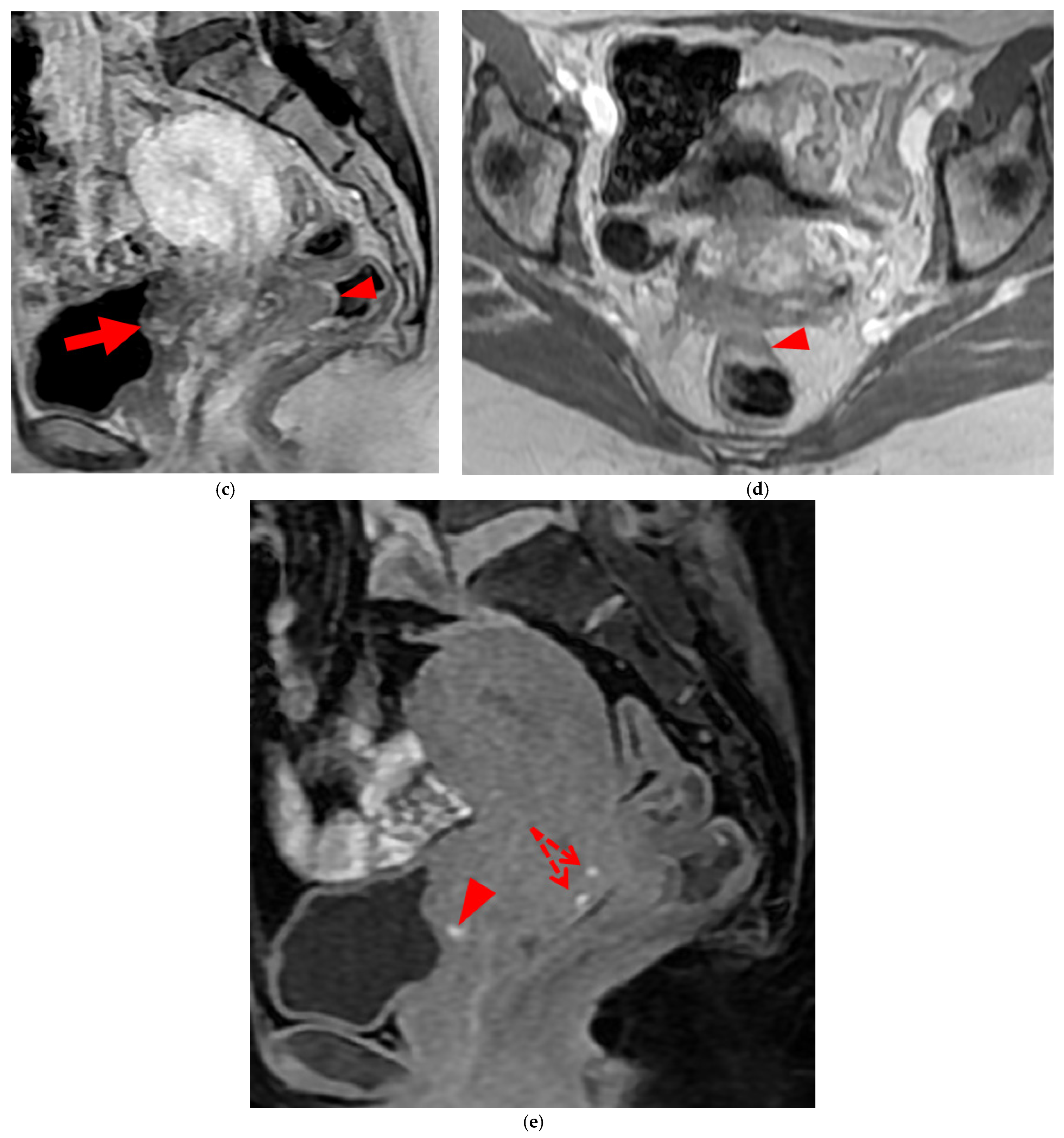 Diagnostics 15 01508 g009b