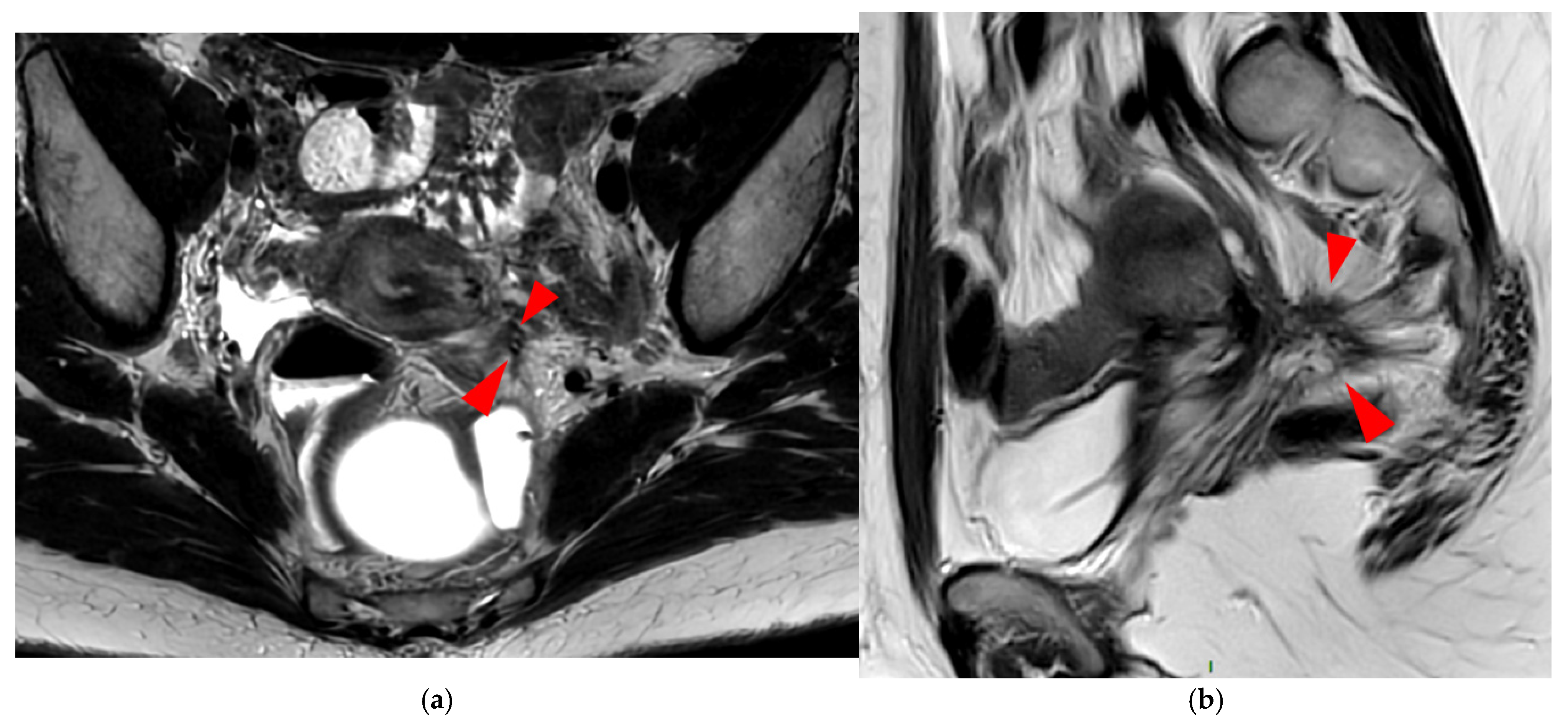 Diagnostics 15 01508 g012