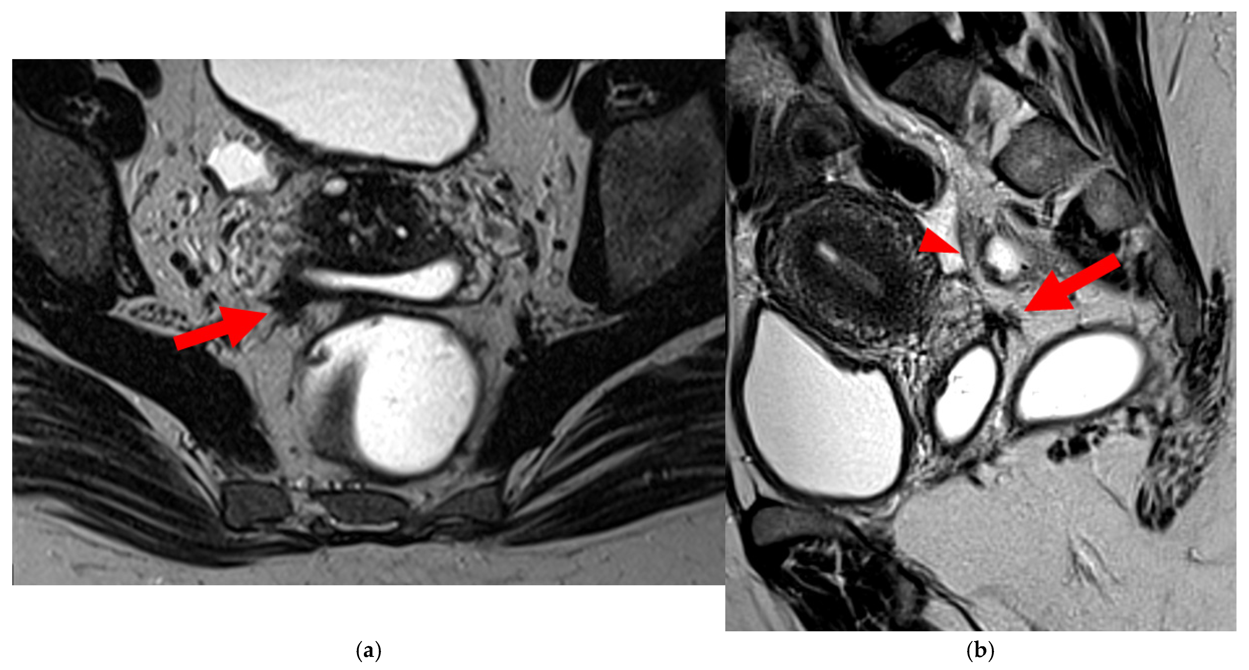 Diagnostics 15 01508 g013