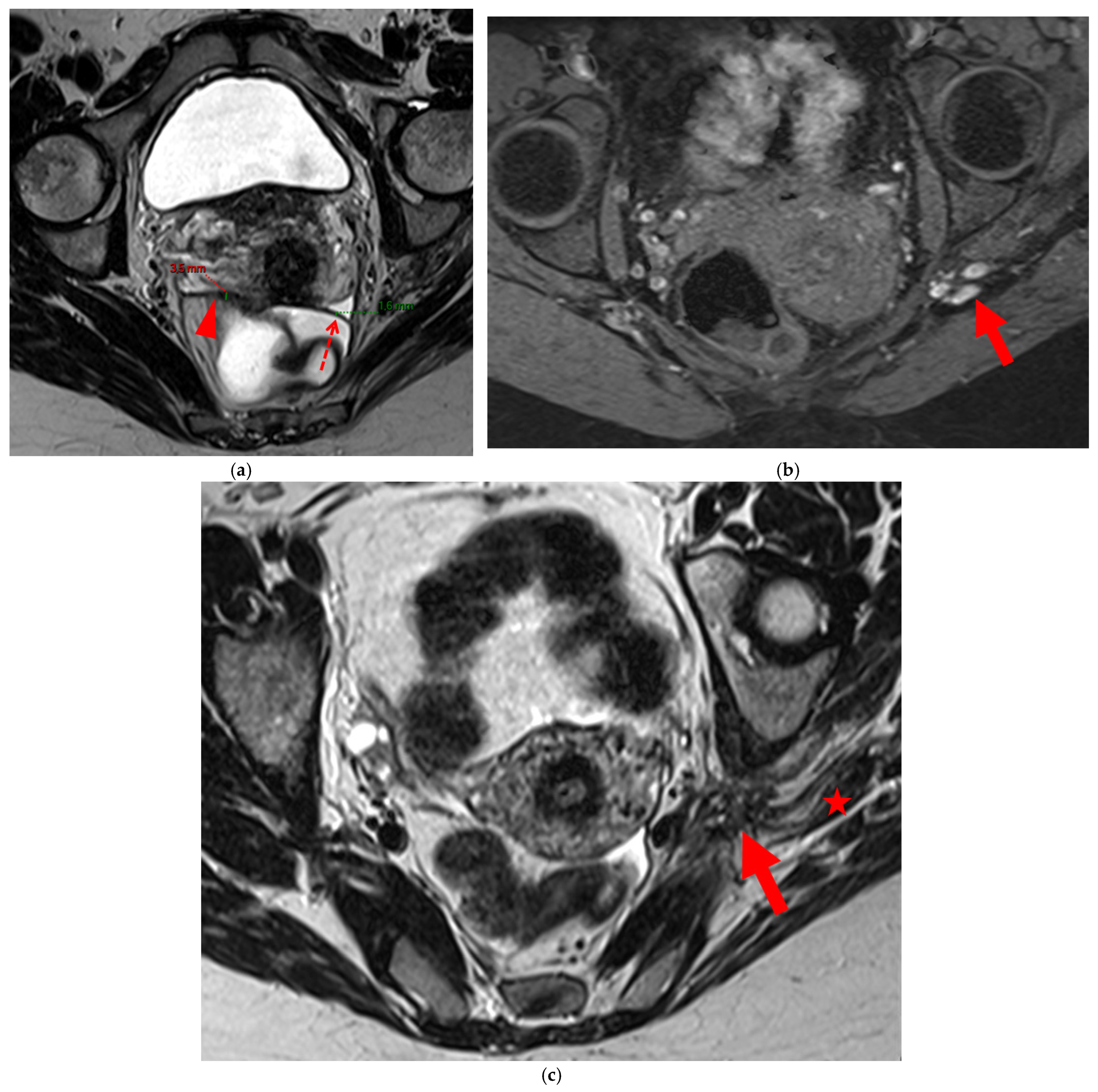 Diagnostics 15 01508 g014