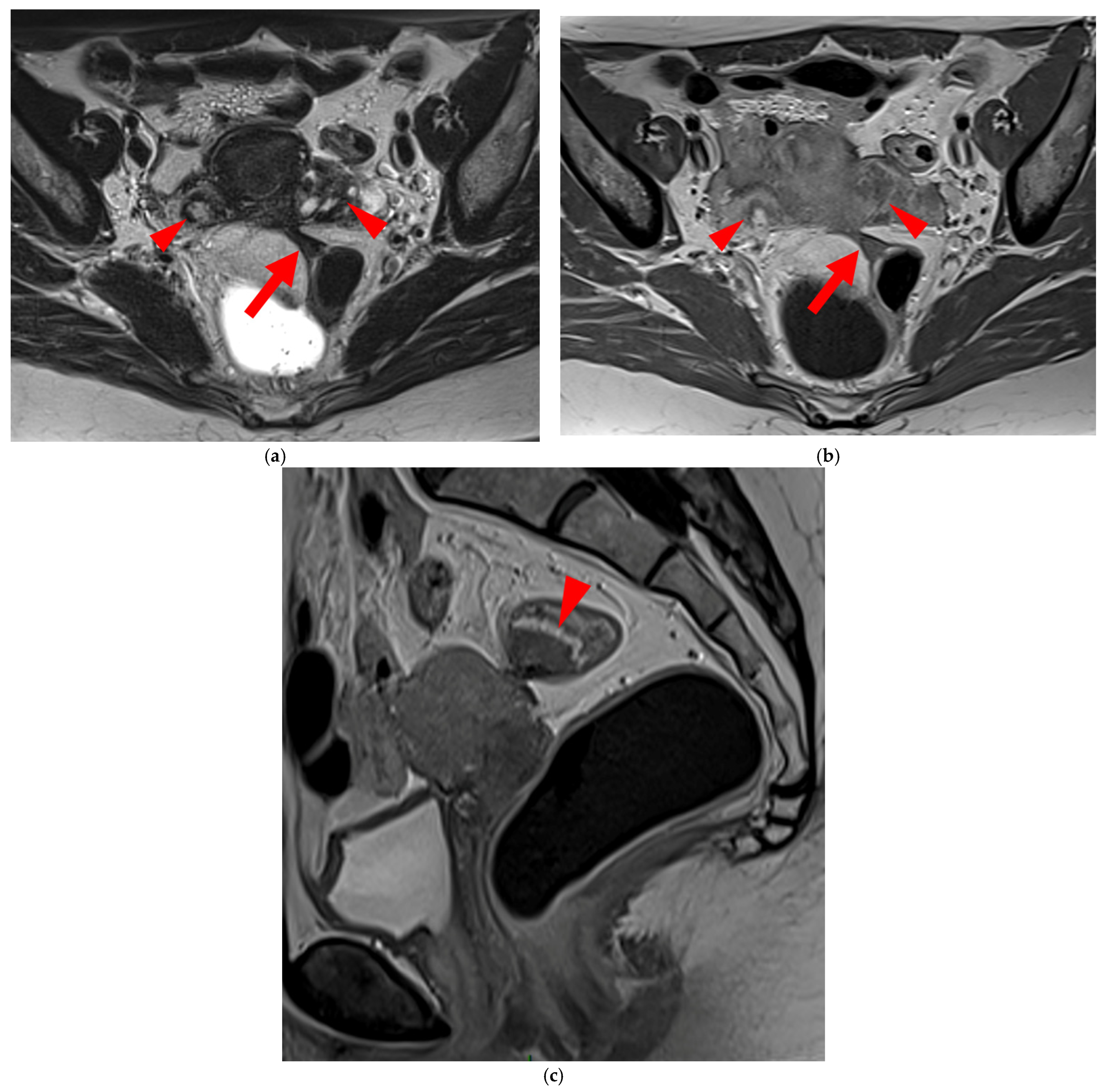 Diagnostics 15 01508 g015