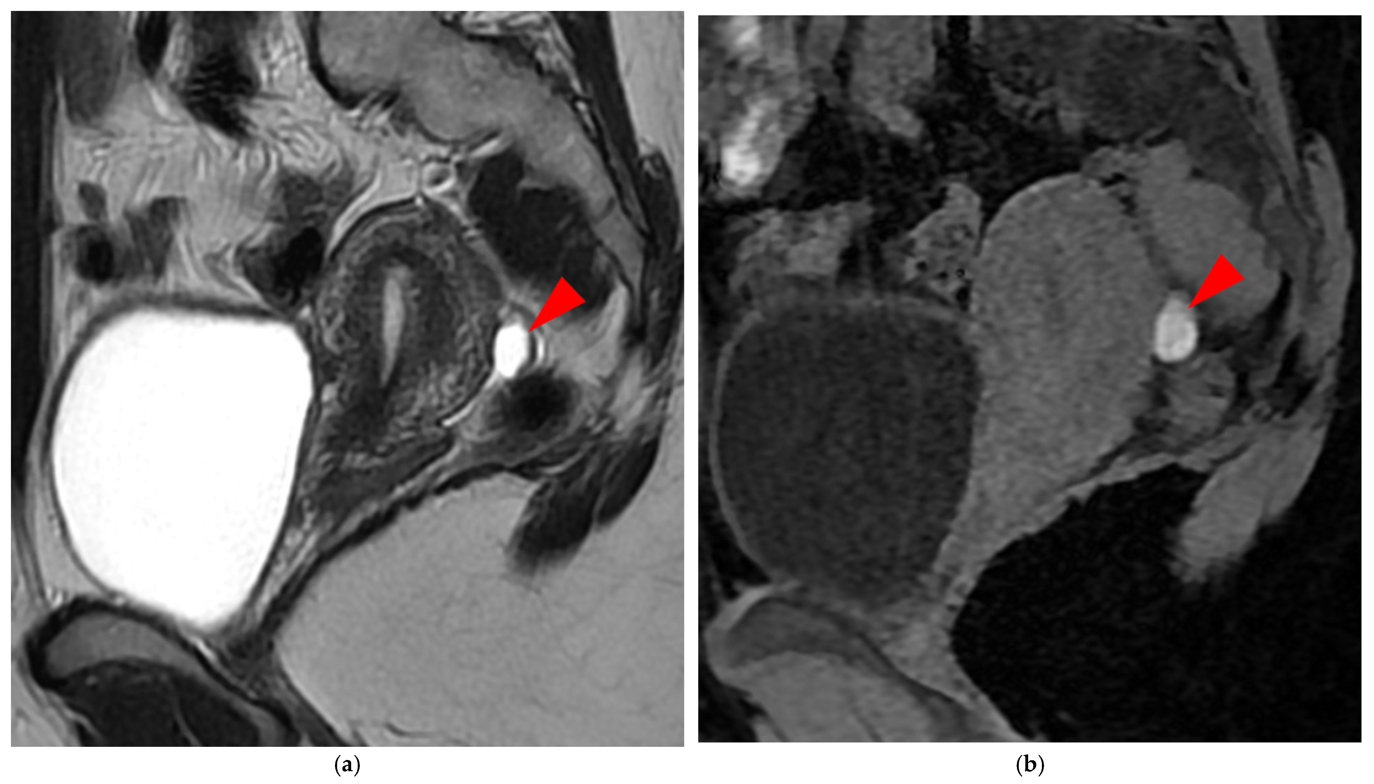 Diagnostics 15 01508 g016