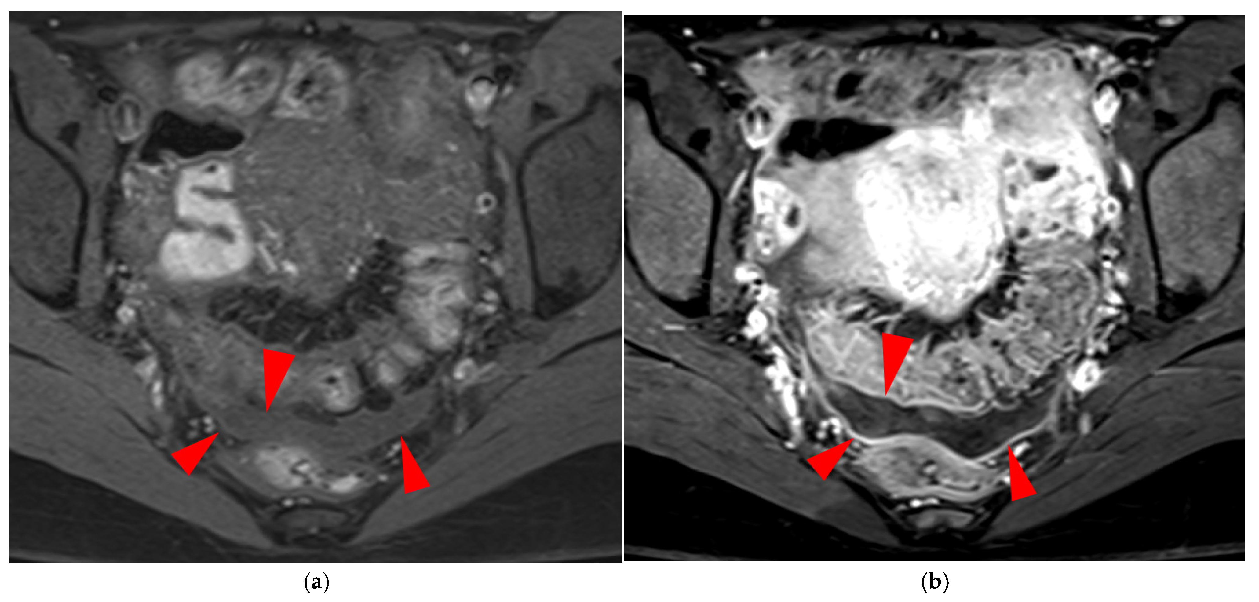 Diagnostics 15 01508 g017