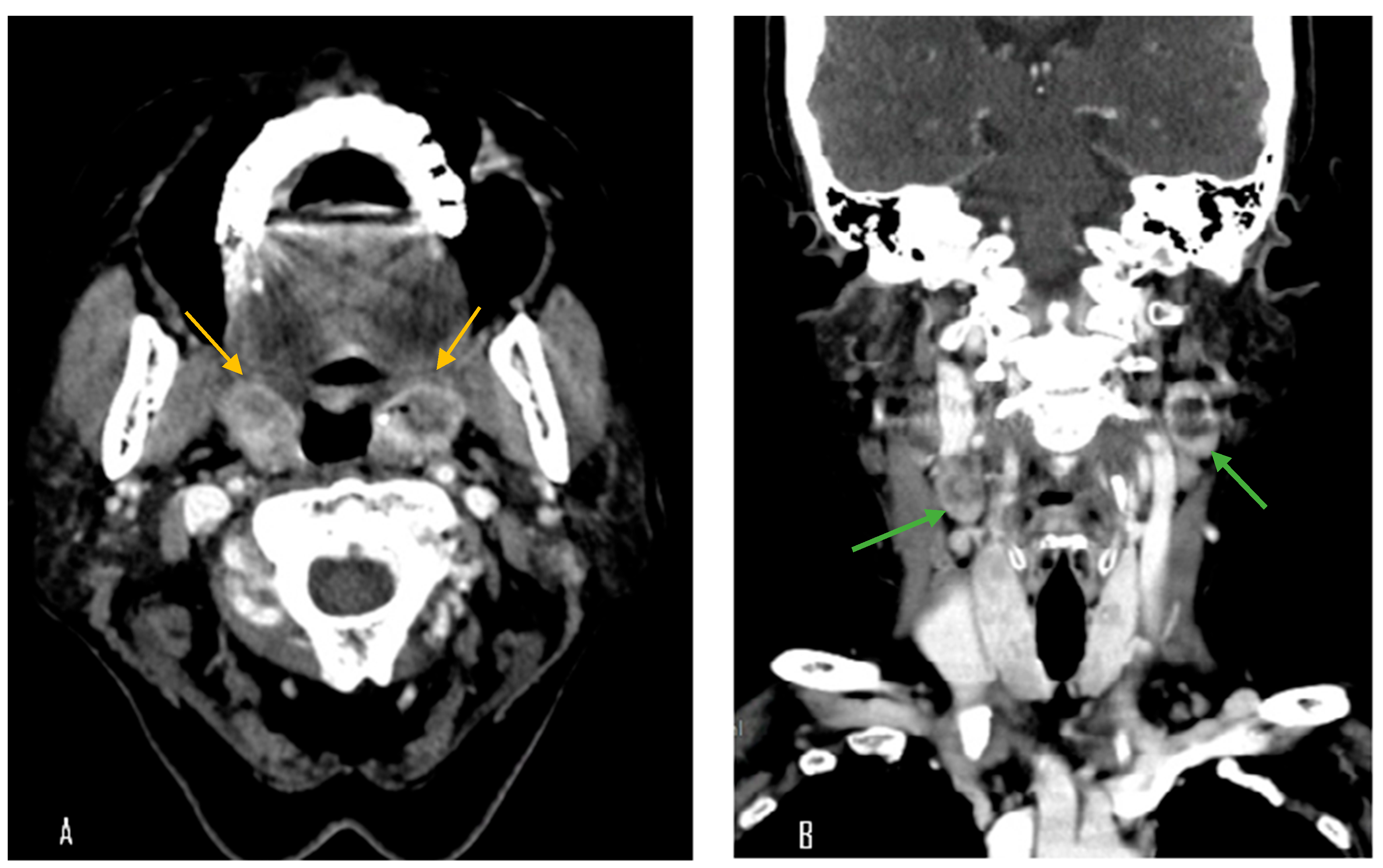 Diagnostics 15 01517 g001