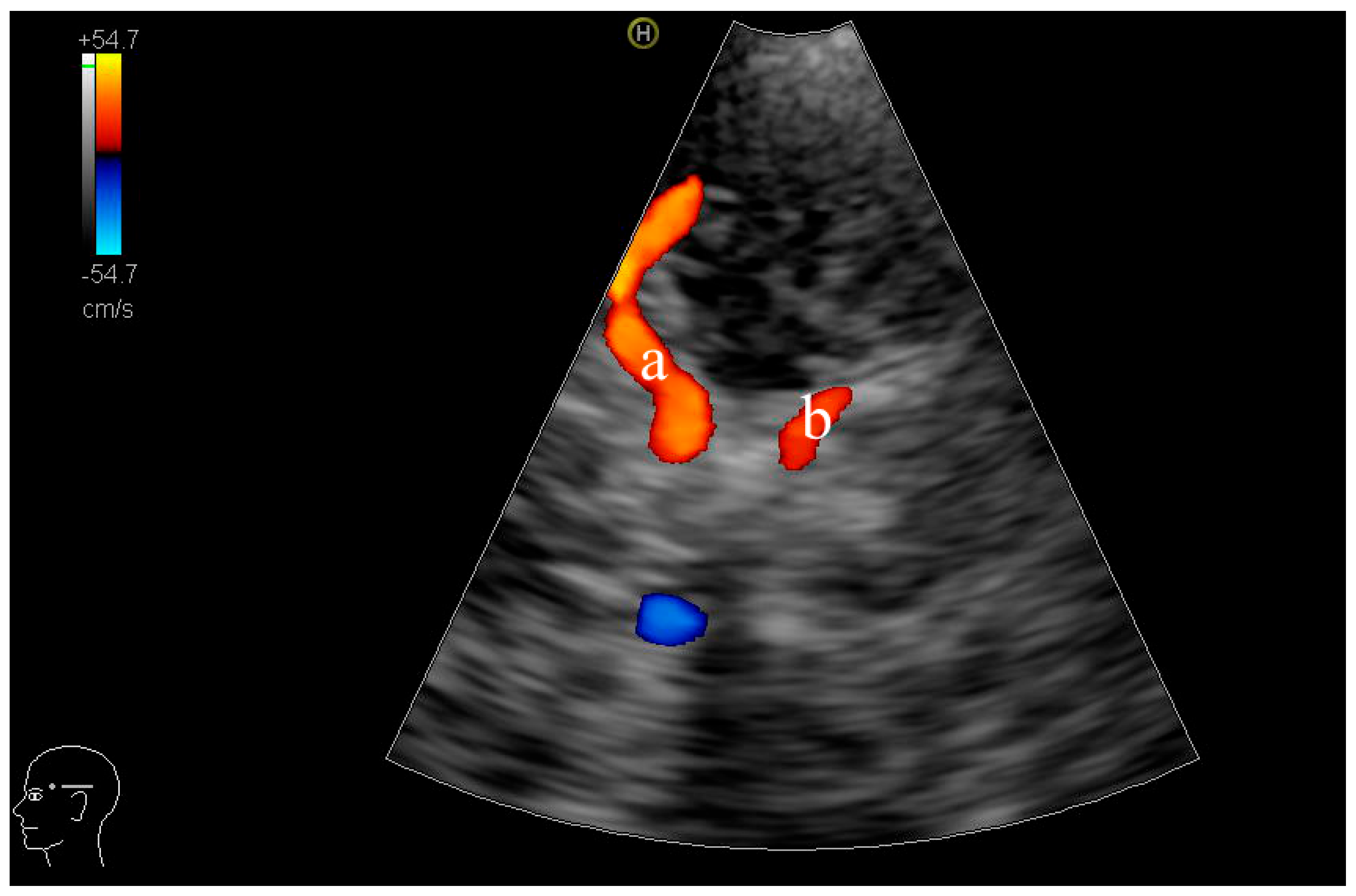 Diagnostics 15 01519 g001