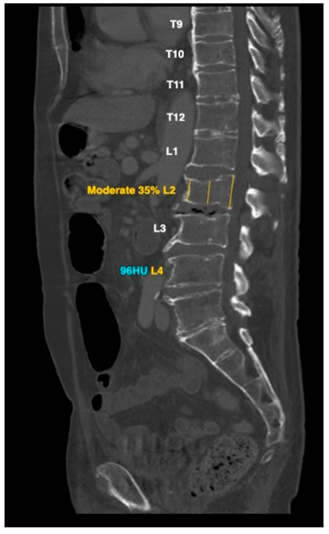 Diagnostics 15 01530 g001