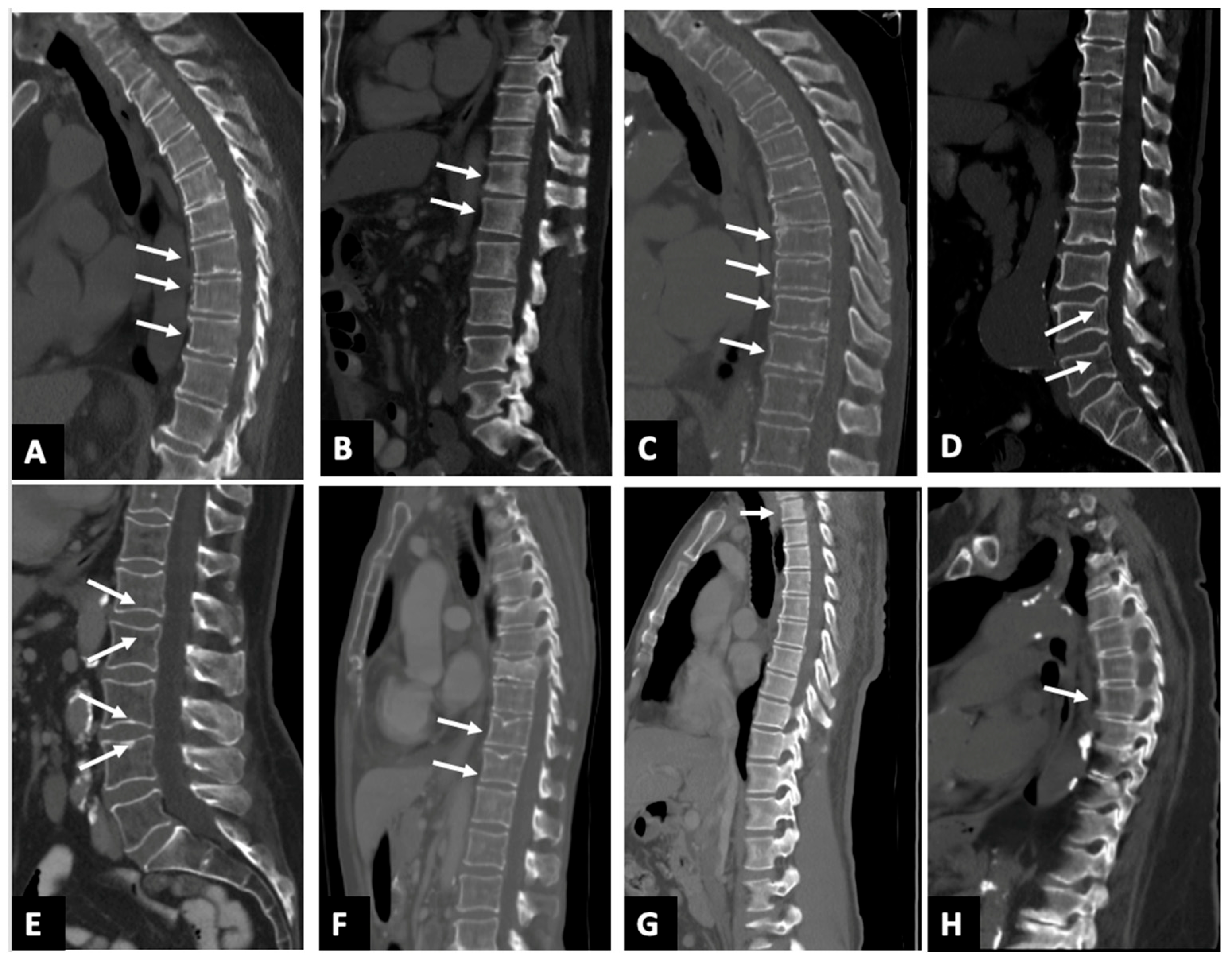 Diagnostics 15 01530 g002