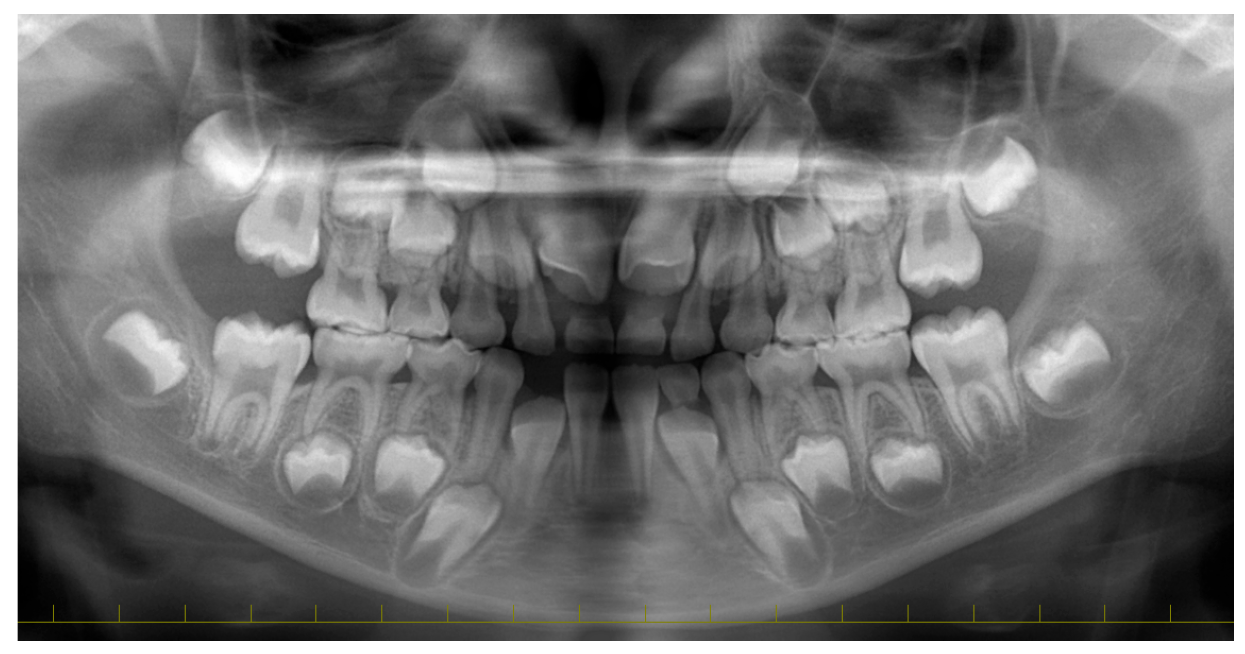 Diagnostics 15 01531 g002