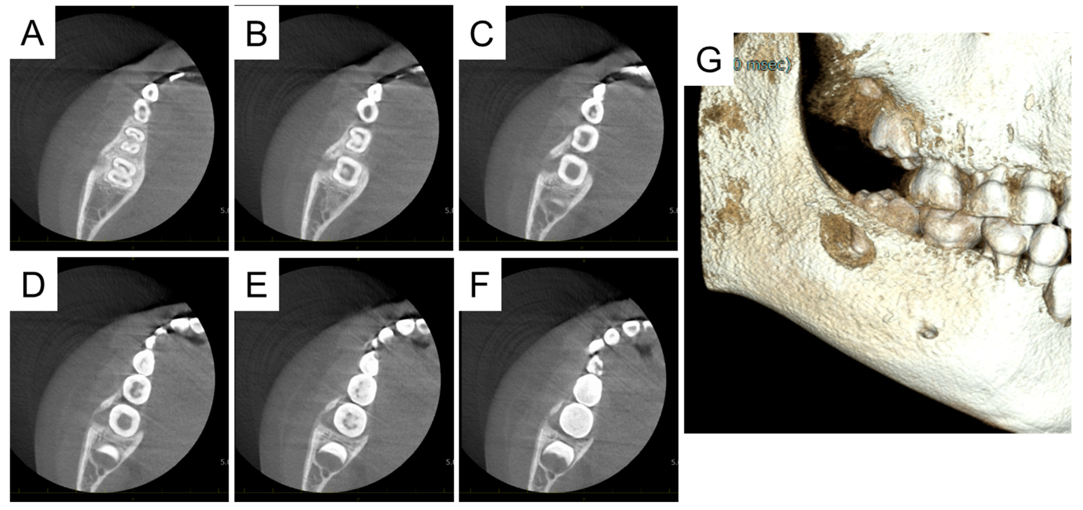 Diagnostics 15 01531 g005