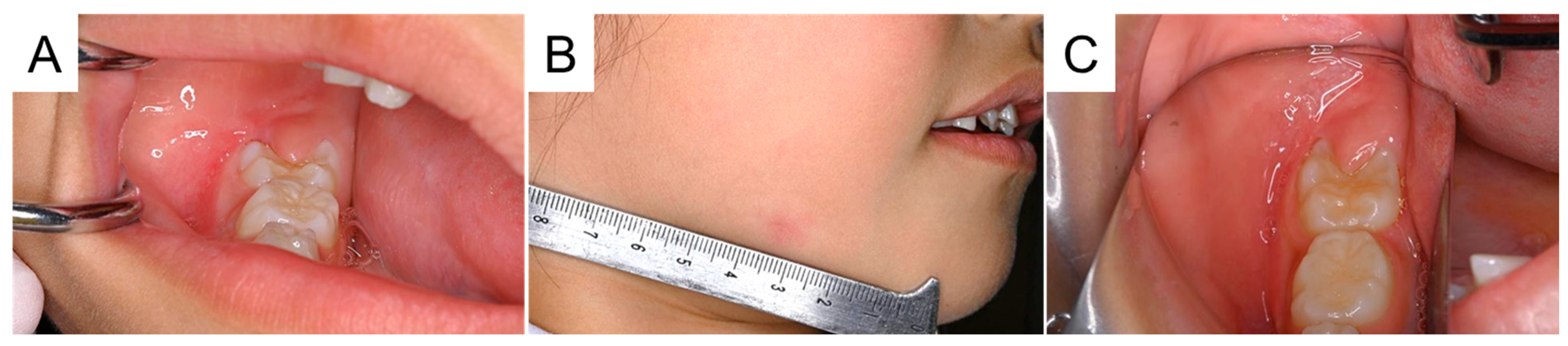 Diagnostics 15 01531 g006