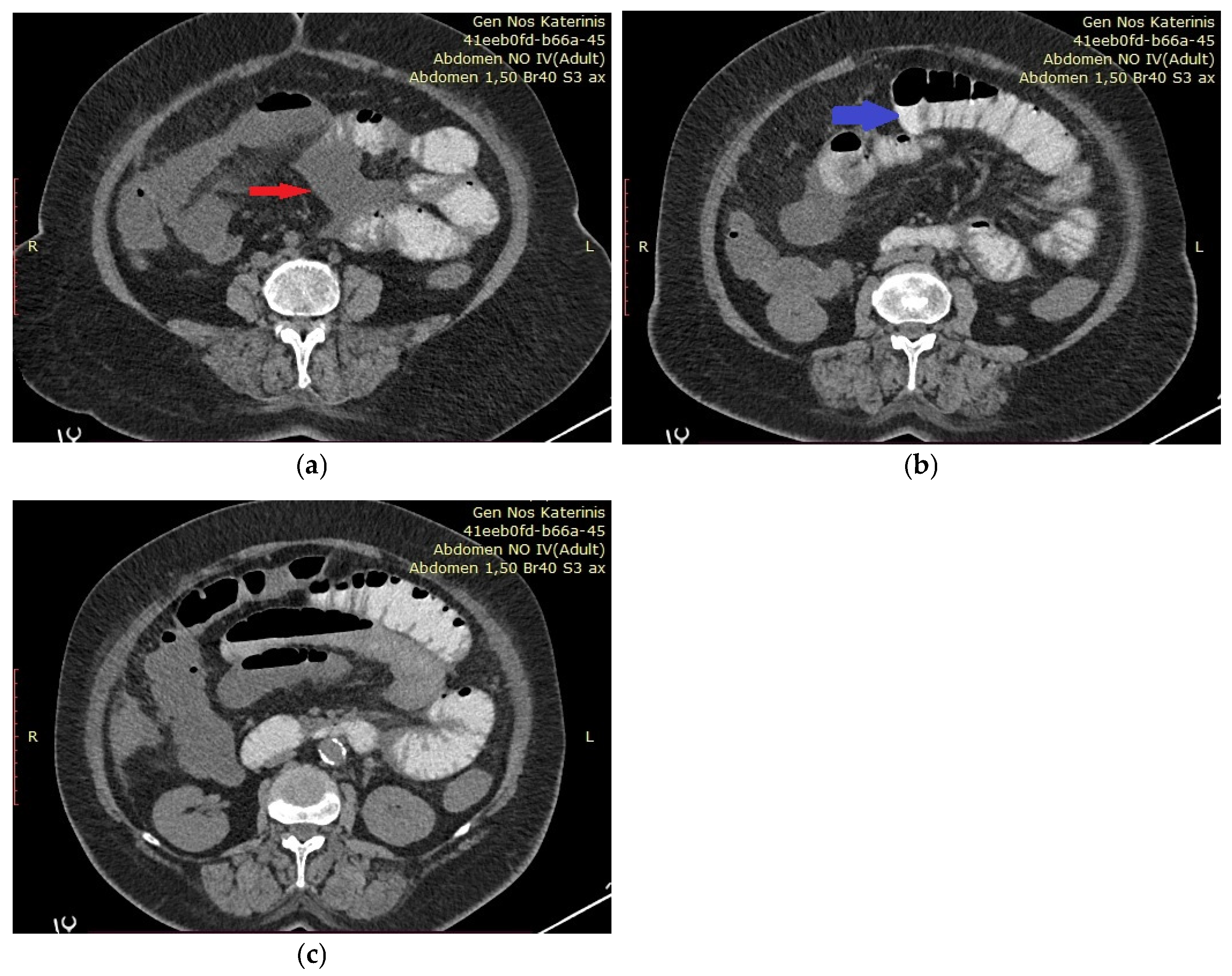 Diagnostics 15 01532 g001