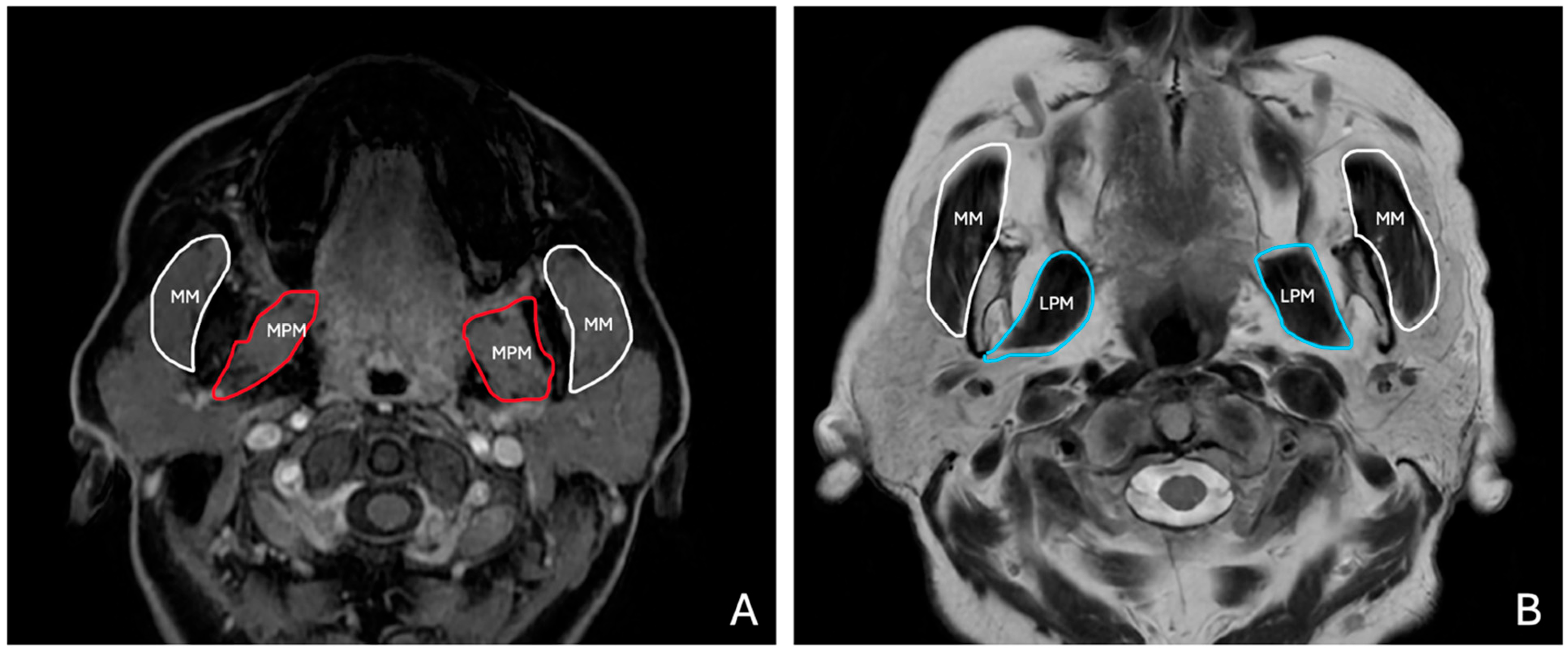 Diagnostics 15 01535 g002