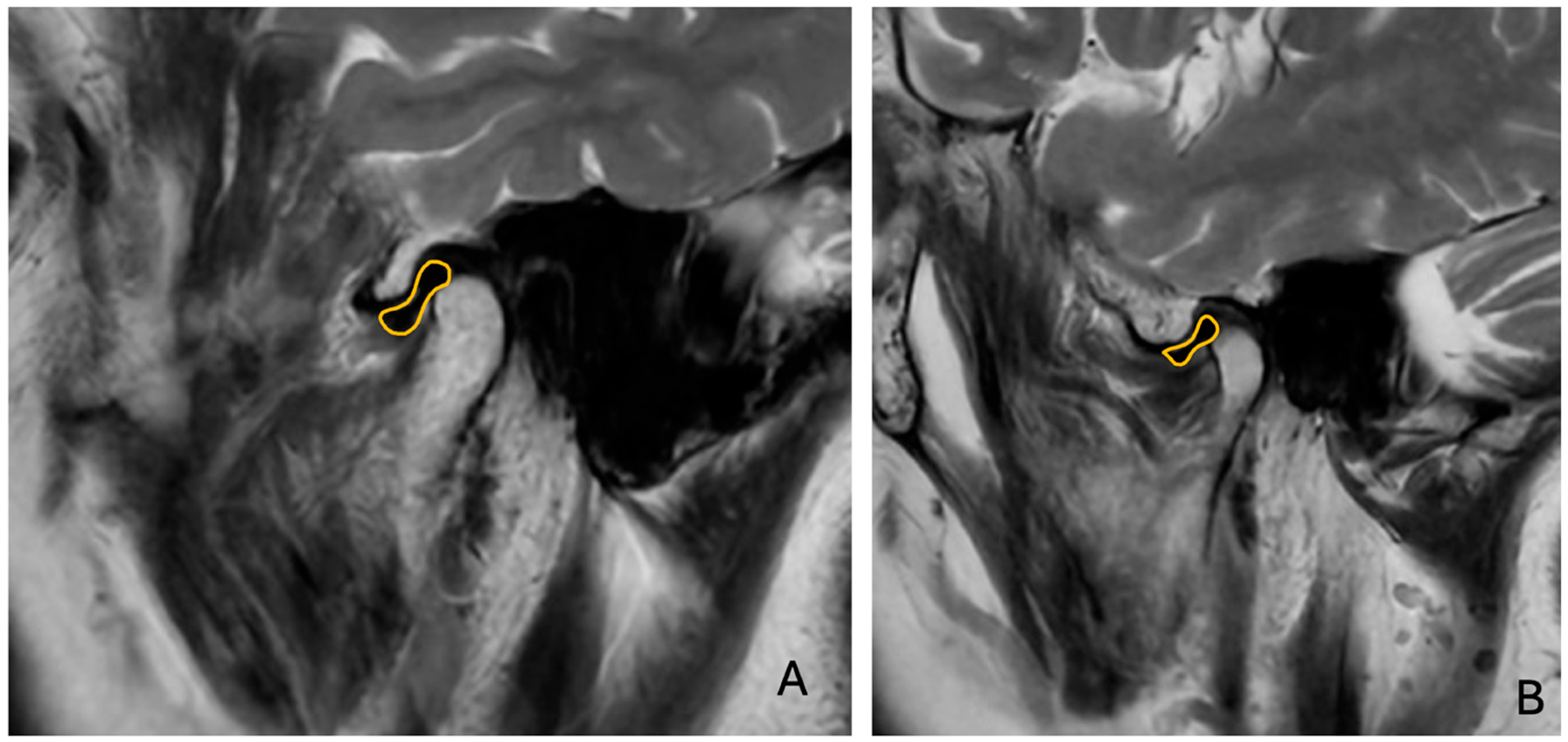Diagnostics 15 01535 g003
