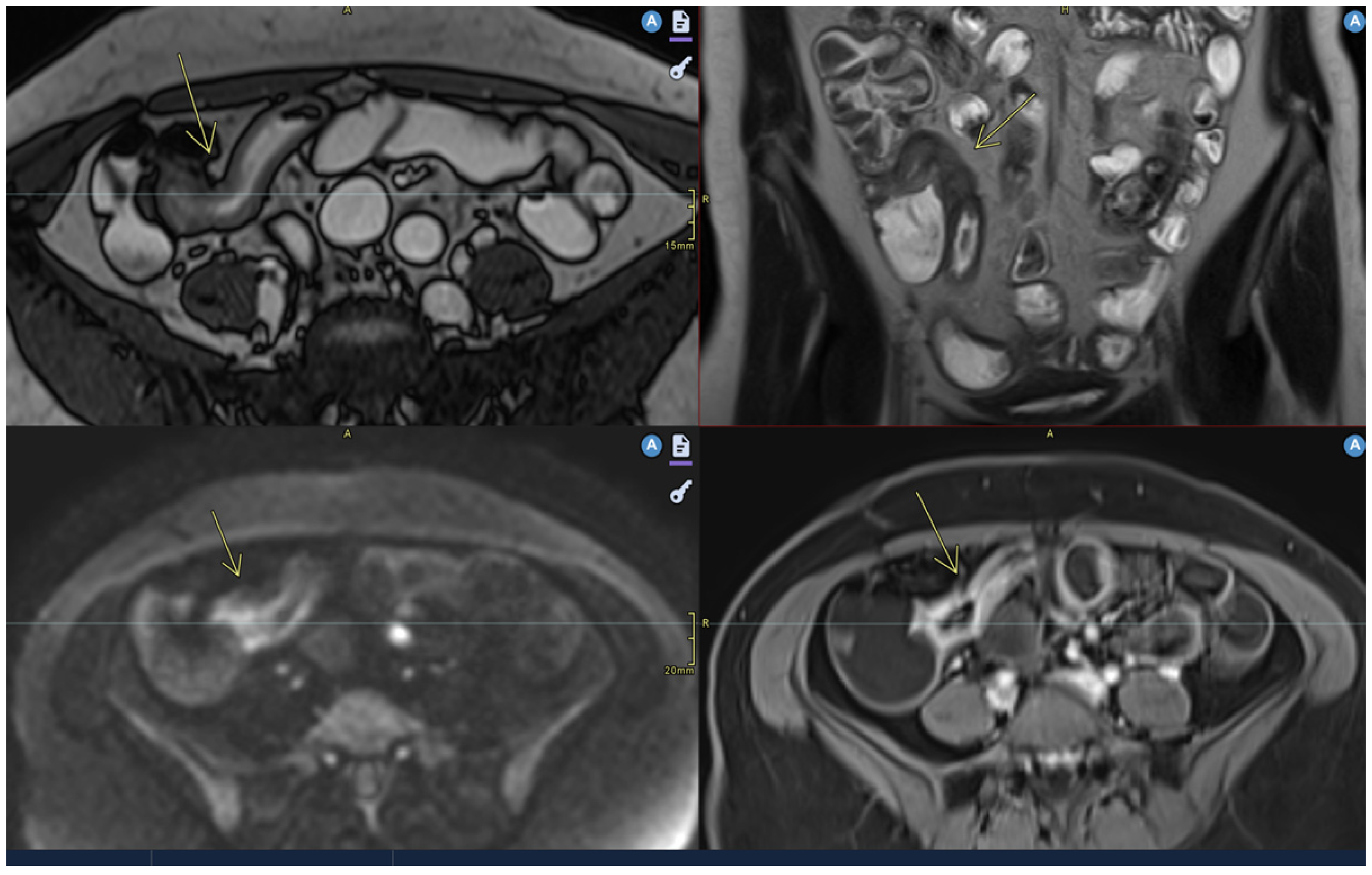 Diagnostics 15 01540 g001
