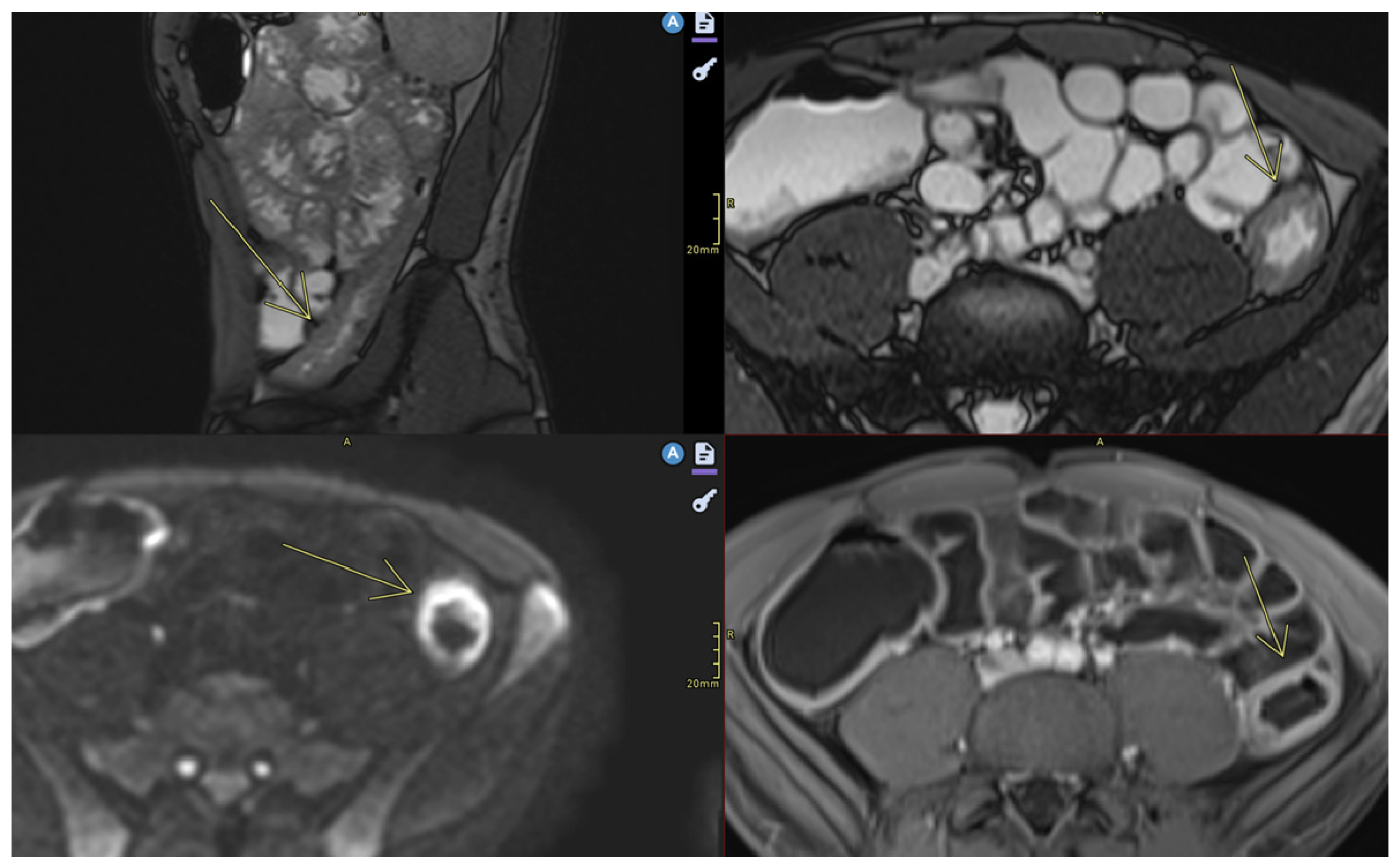 Diagnostics 15 01540 g003