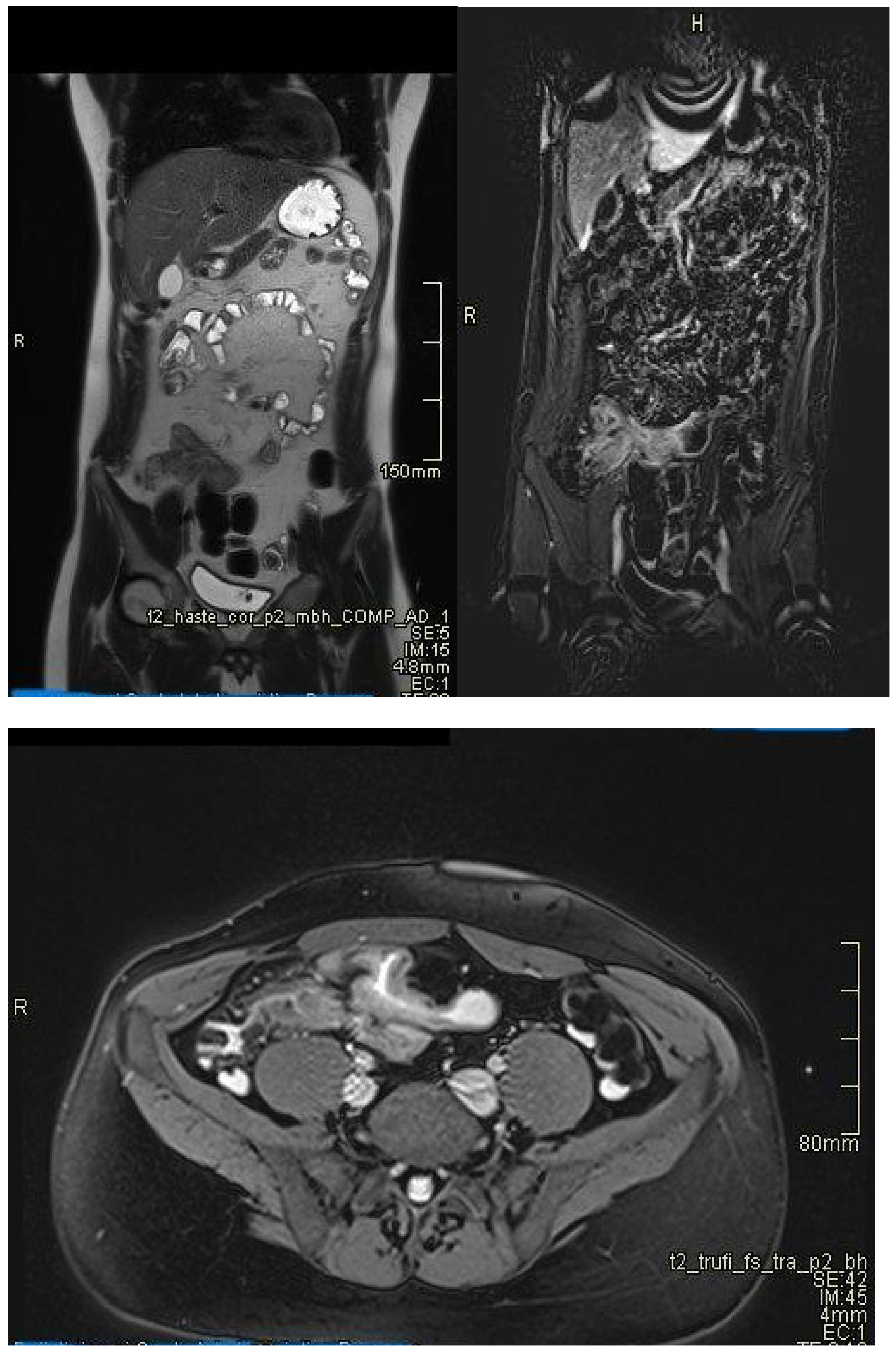 Diagnostics 15 01540 g005