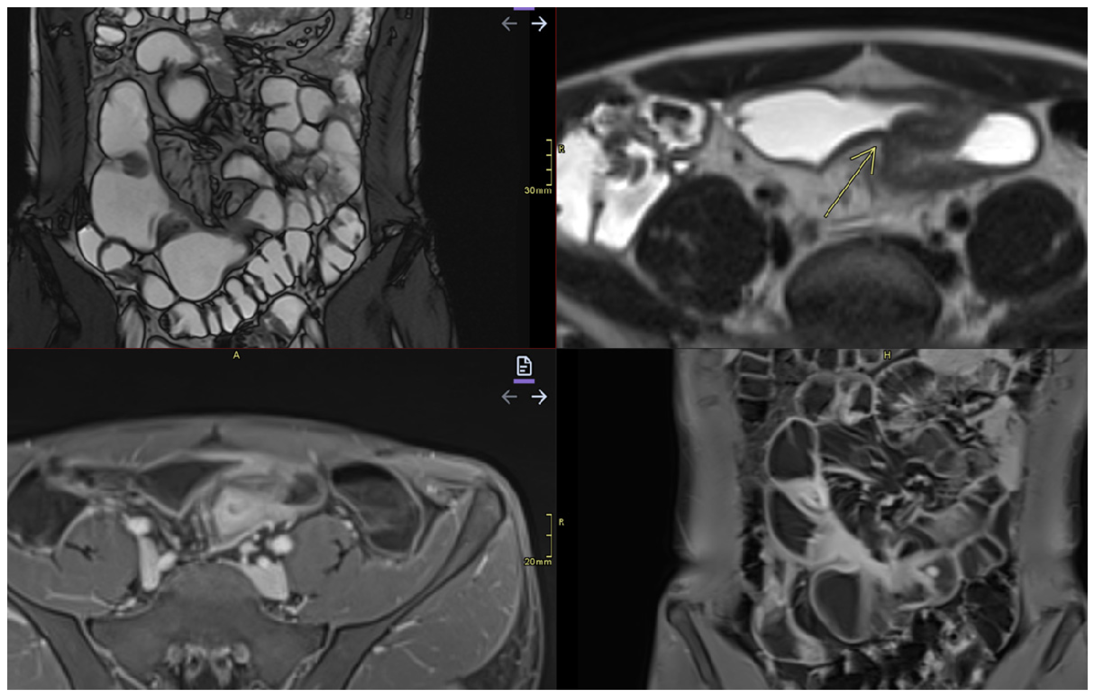 Diagnostics 15 01540 g007