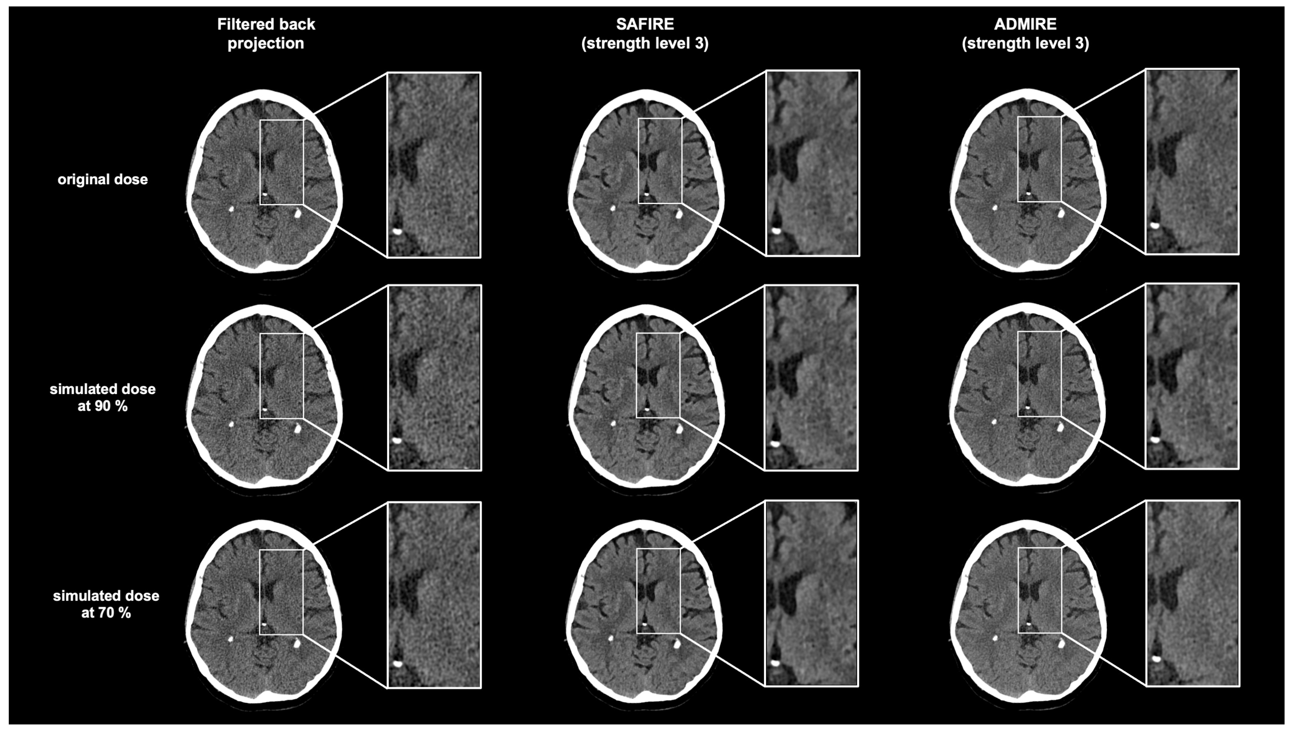 Diagnostics 15 01541 g004