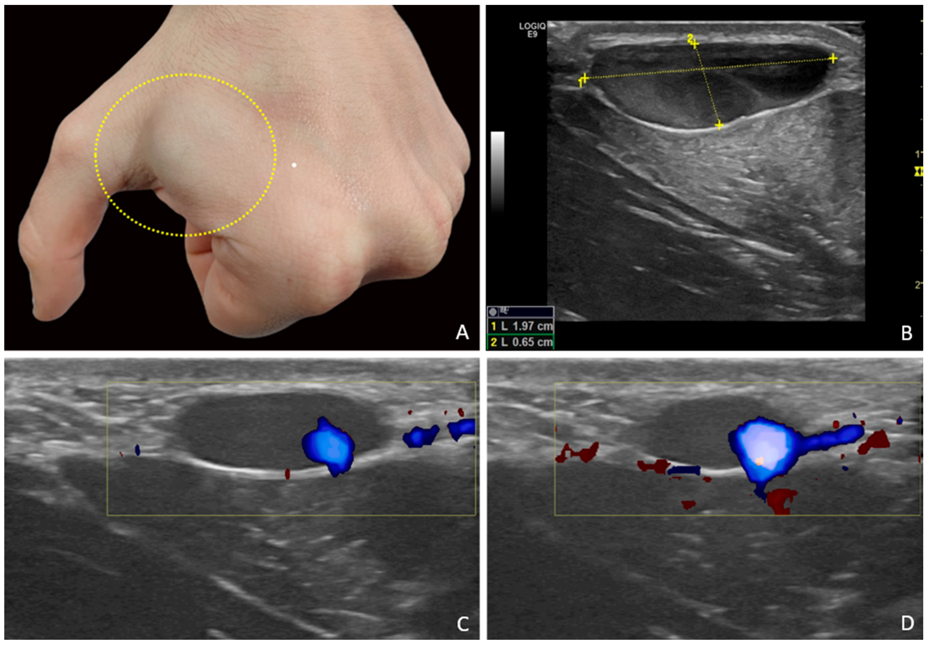 Diagnostics 15 01546 g001