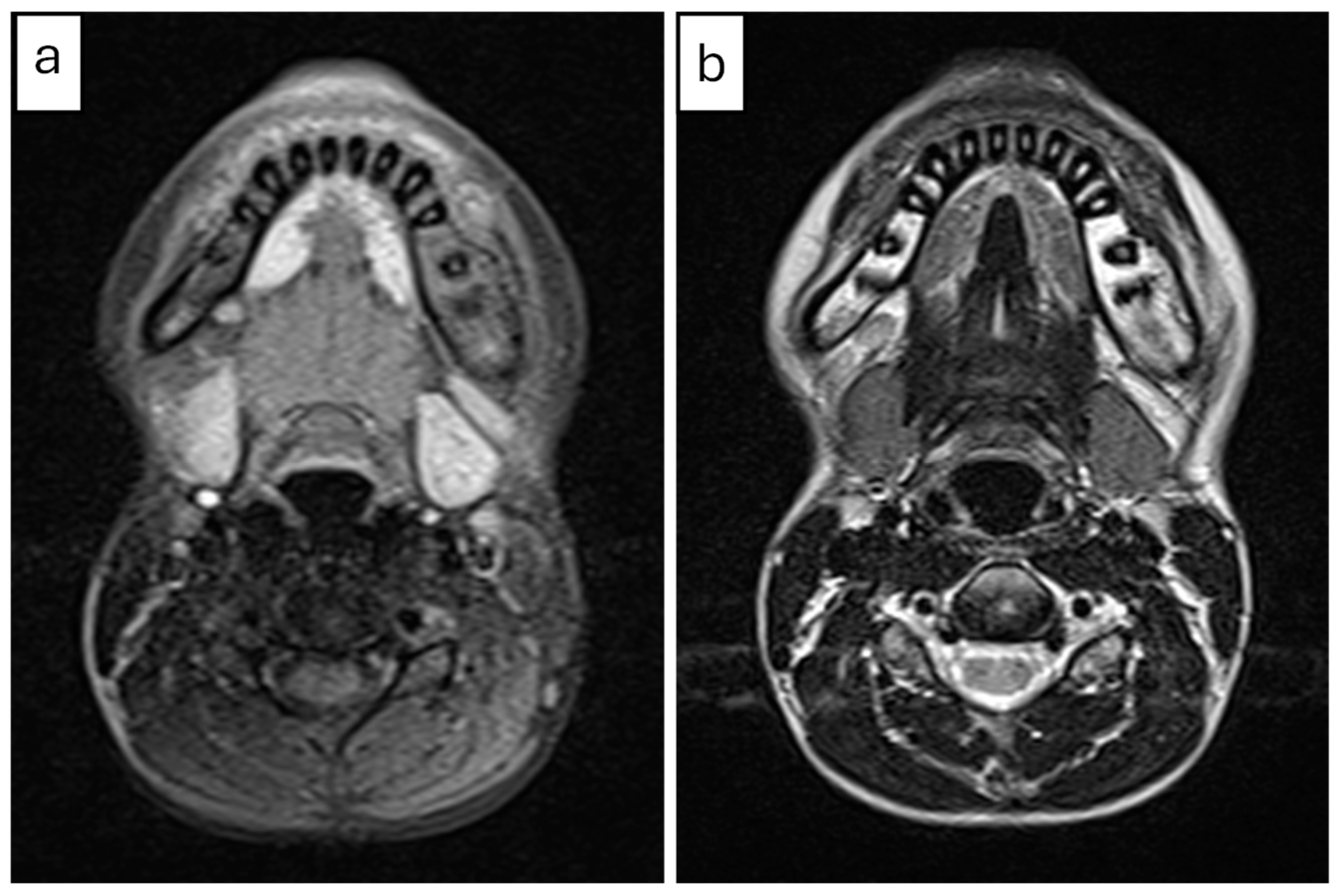 Diagnostics 15 01549 g002