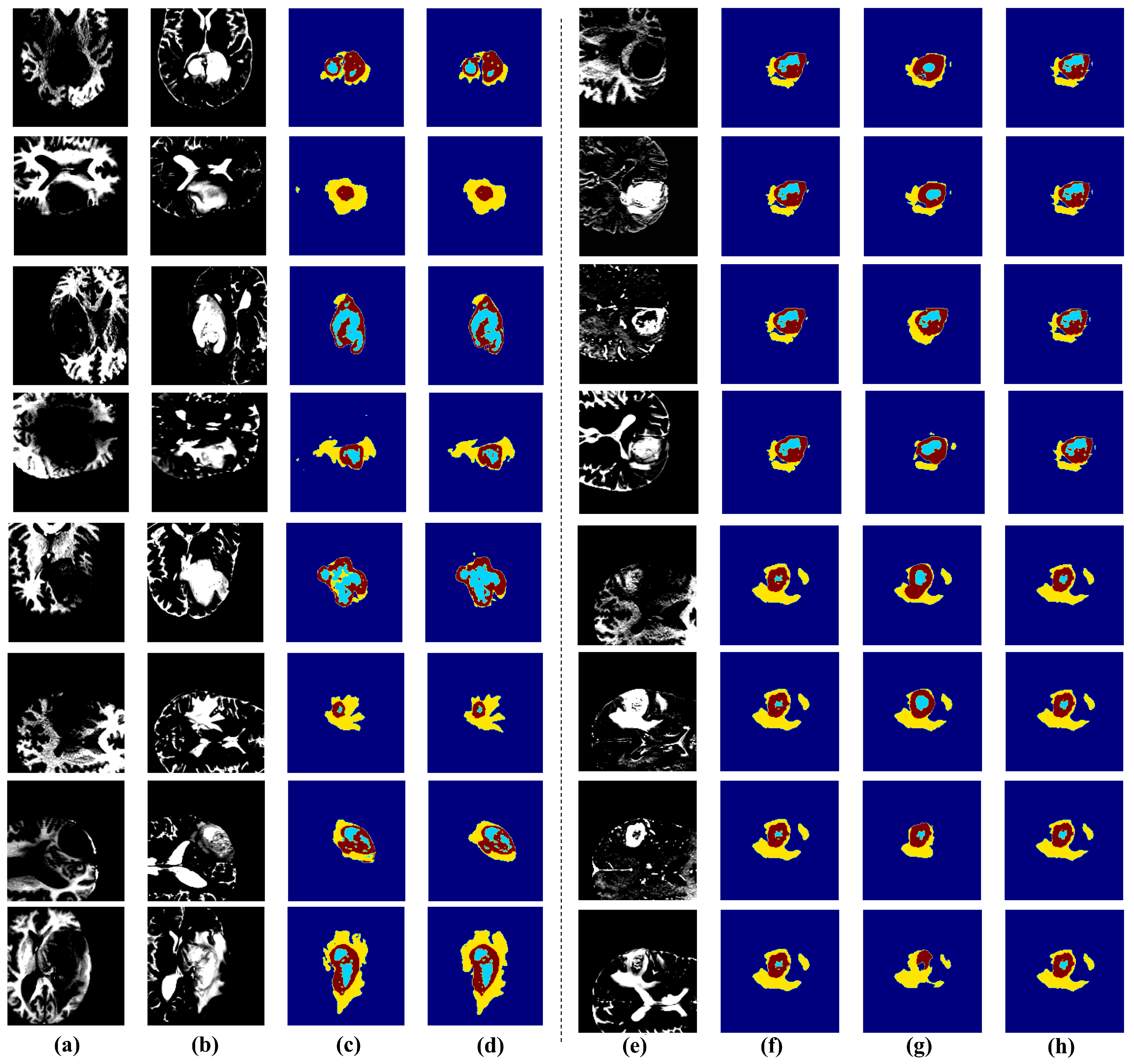 Diagnostics 15 01552 g005