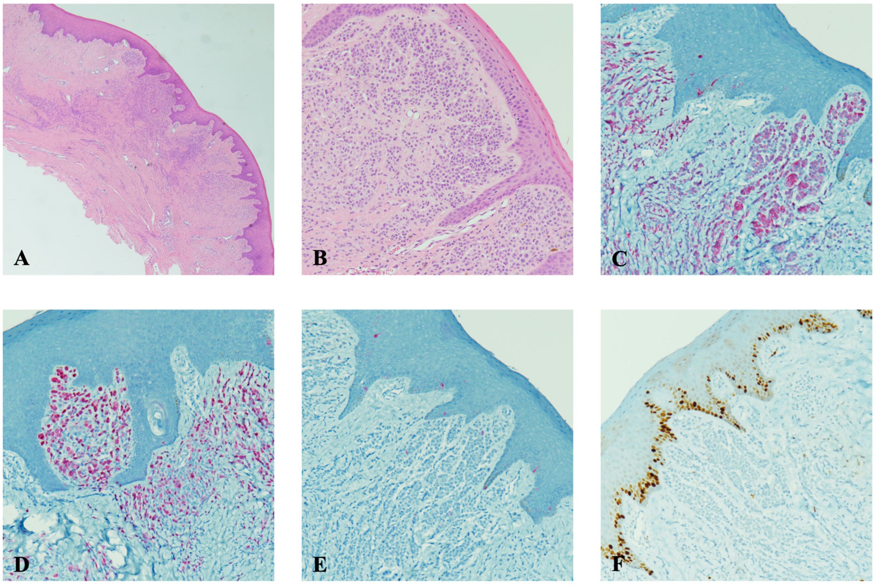 Diagnostics 15 01554 g003 Diagnostics 15 01554 g003