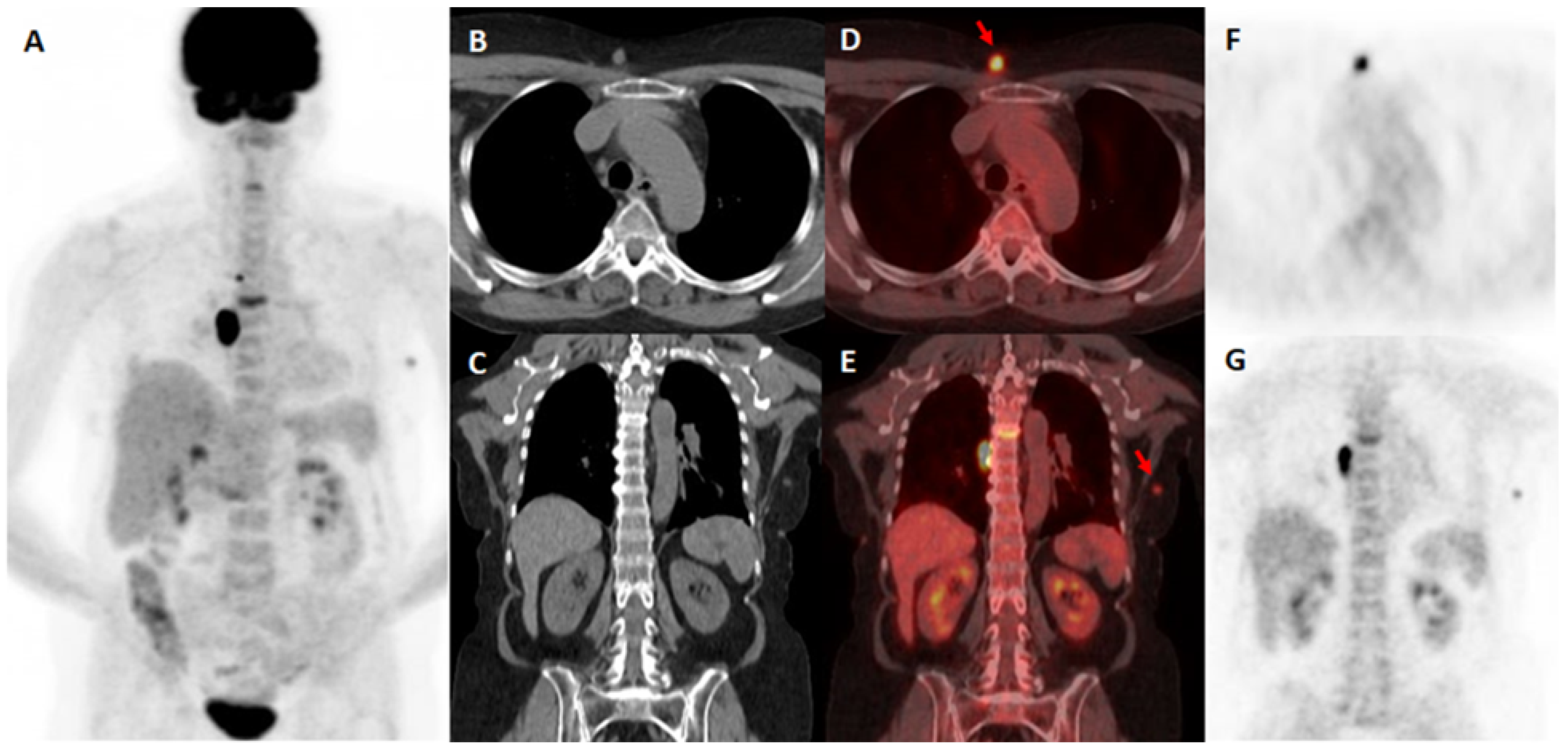Diagnostics 15 01560 g001