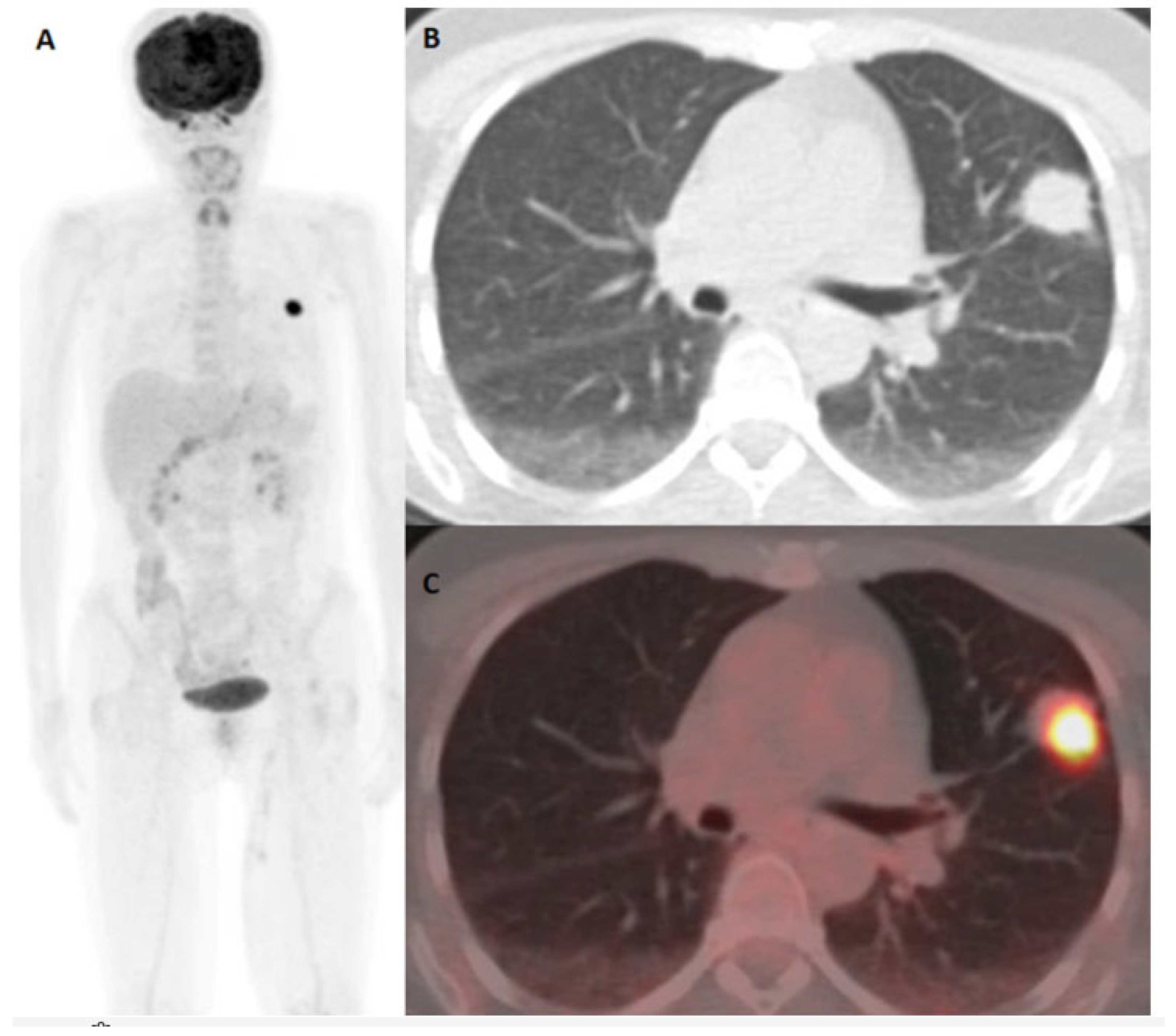 Diagnostics 15 01560 g002