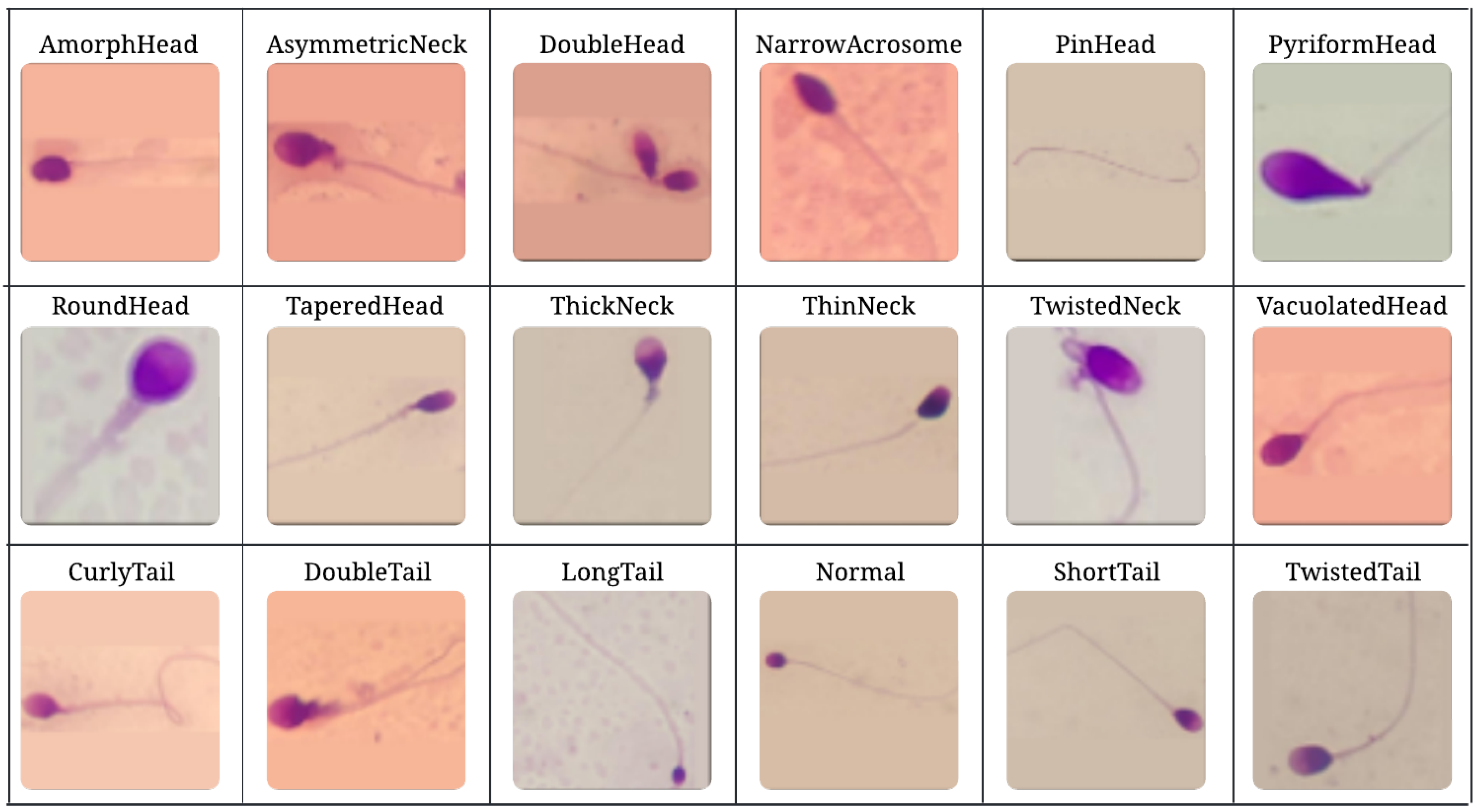 Diagnostics 15 01564 g001