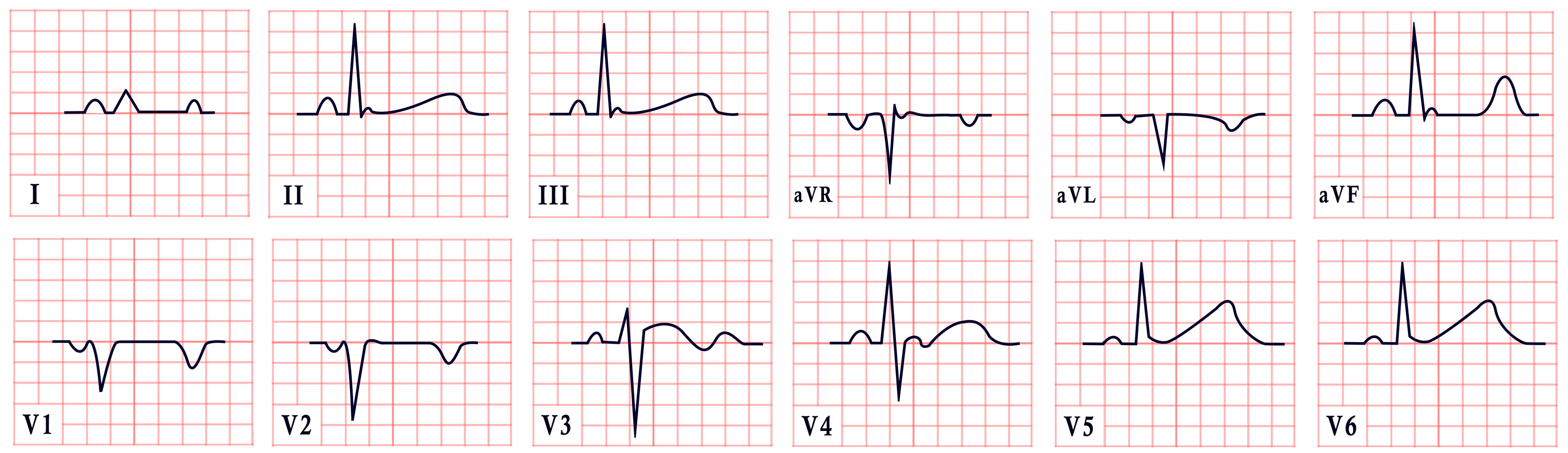 Diagnostics 15 01568 g001